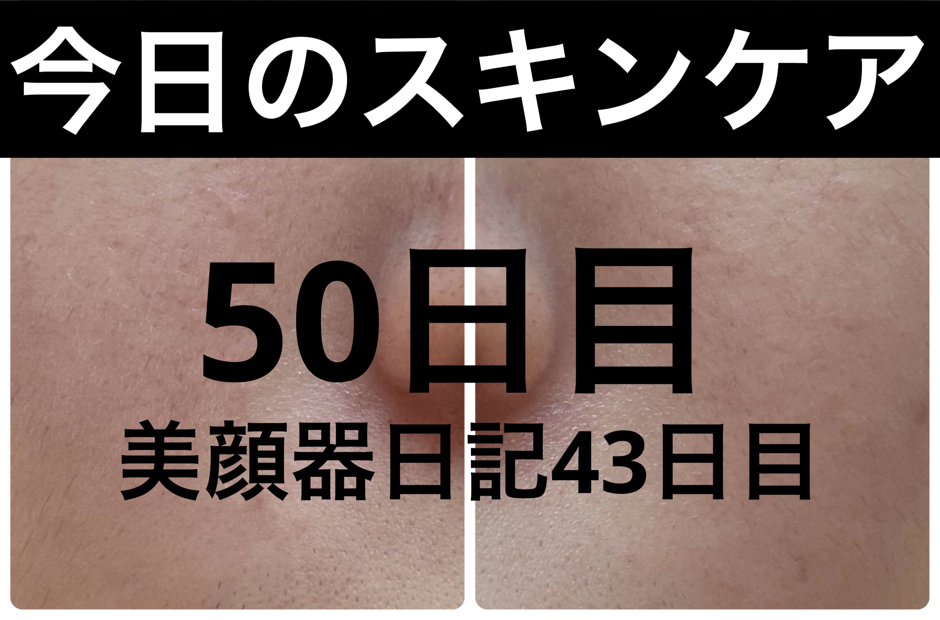 AGE-R ブースタープロ/MEDICUBE/美顔器・マッサージを使ったクチコミ（1枚目）