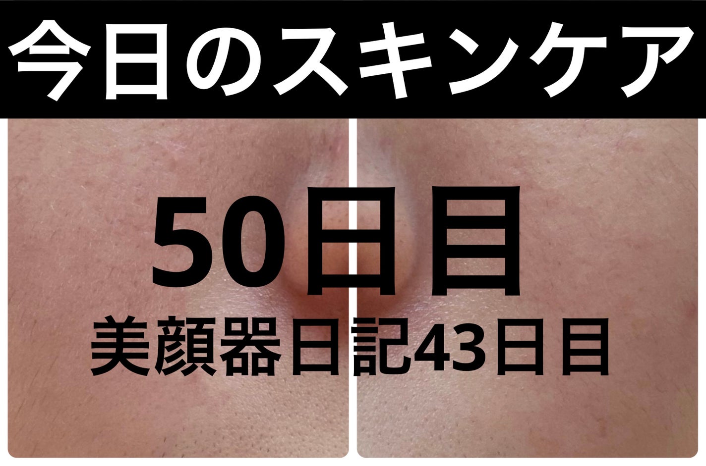 パーフェクトVリフティングプレミアムプラスマスク/avajar/シートマスク・パックを使ったクチコミ(1枚目)