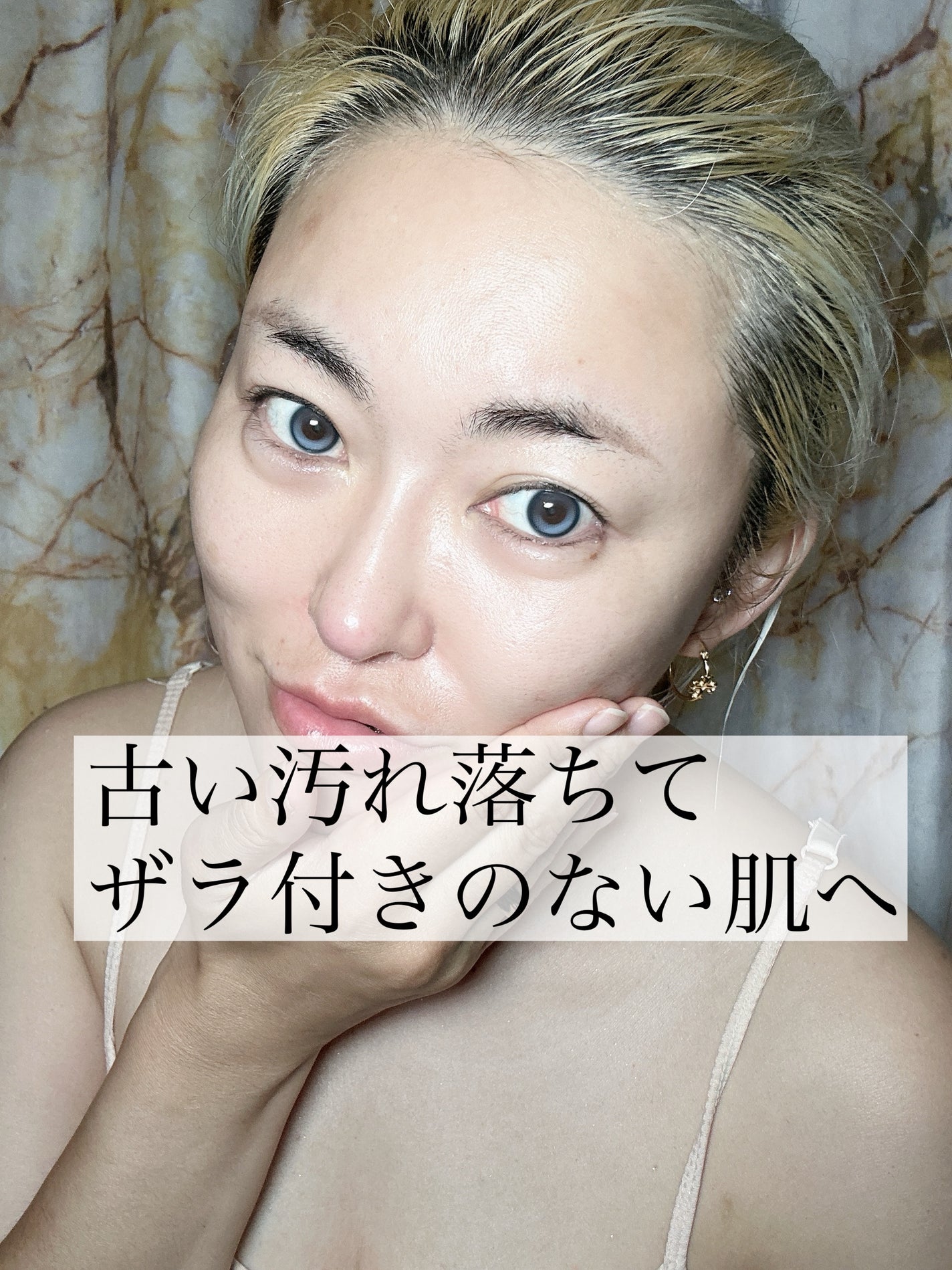 エファクラ ピールケア セラム/ラ ロッシュ ポゼ/美容液を使ったクチコミ(3枚目)