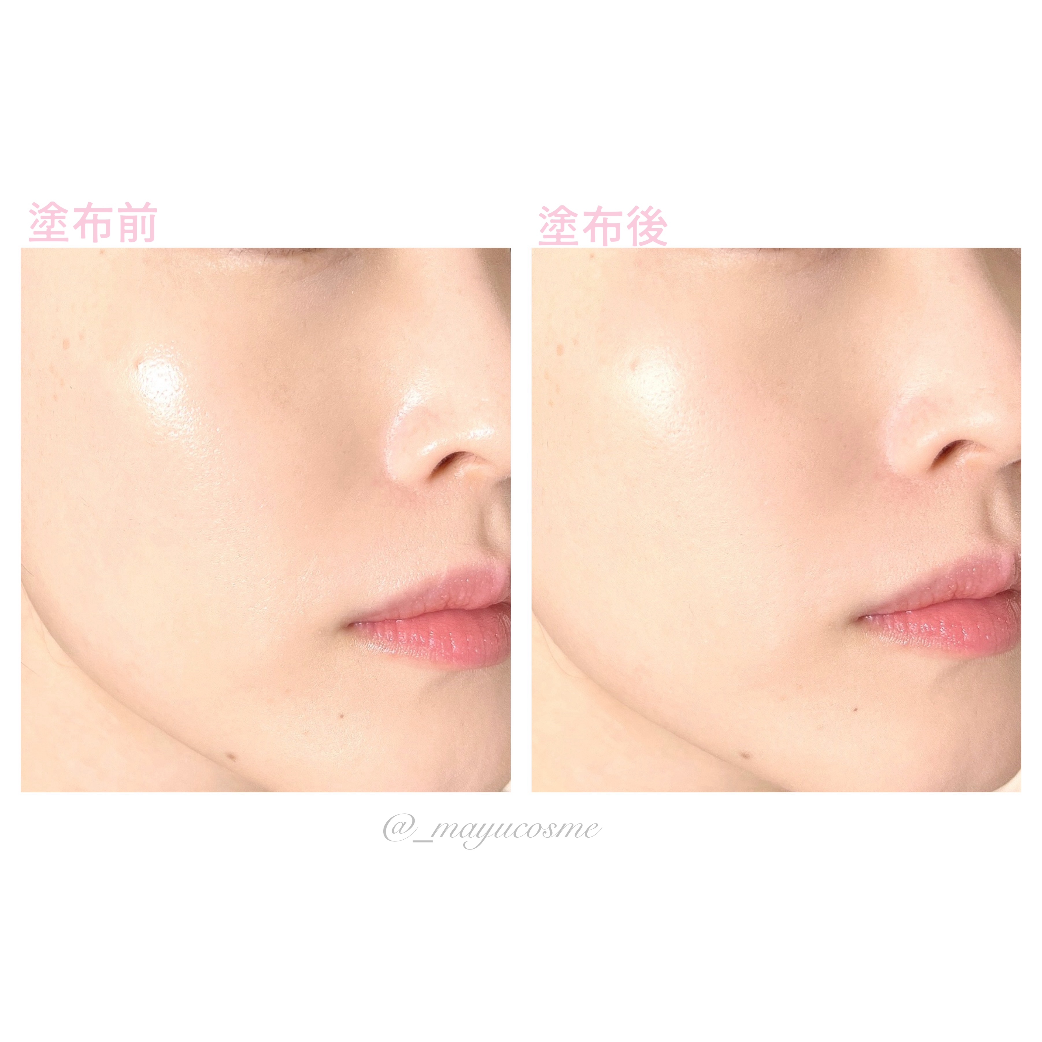 SUIKO HC ビタミン5エッセンスマスク/SUIKO HATSUCURE/シートマスク・パックを使ったクチコミ（3枚目）