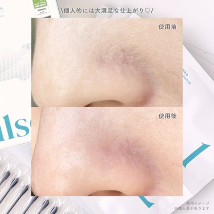 ナチュラルマイルドクリアノーズパック/ilso/シートマスク・パックを使ったクチコミ(4枚目)