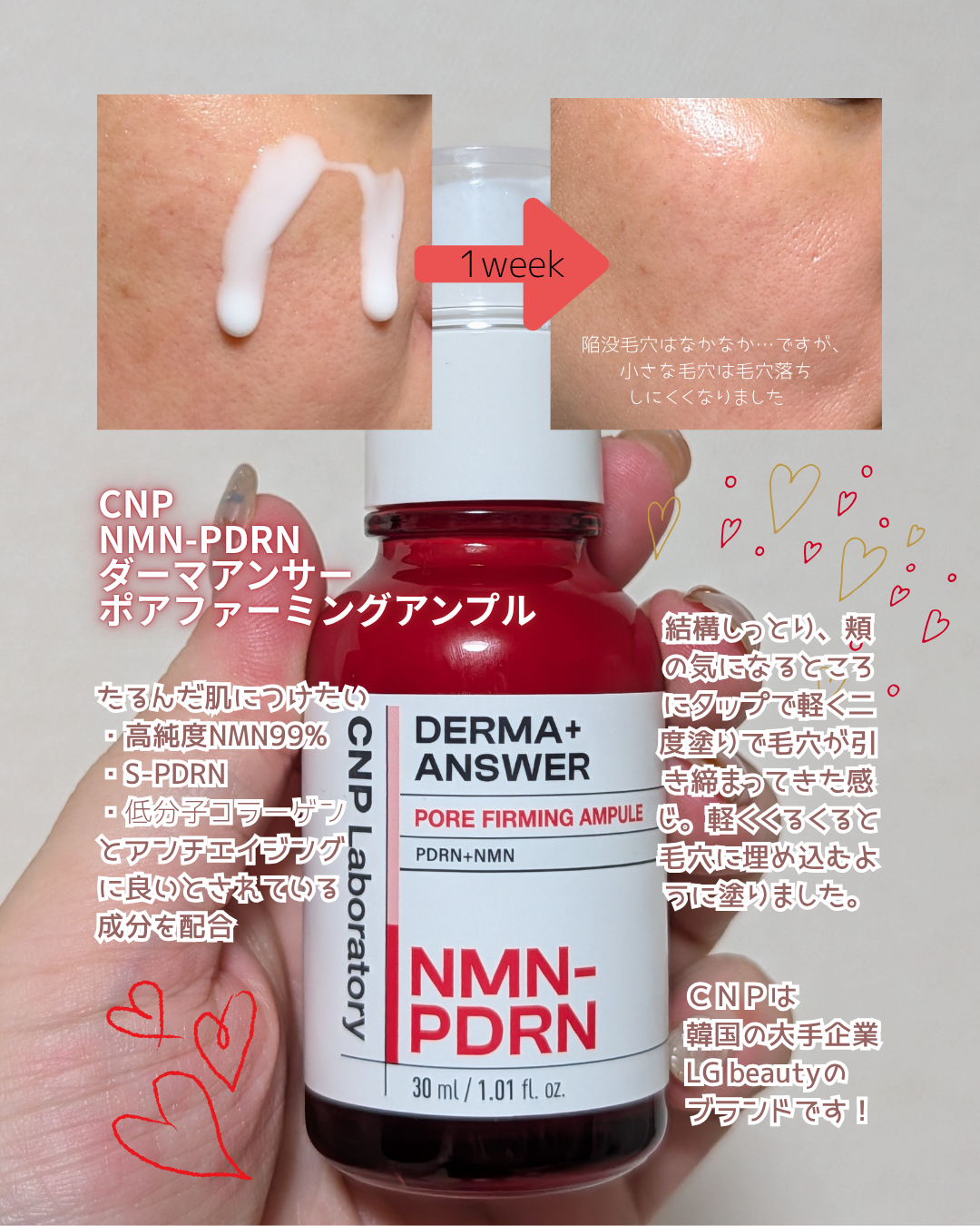 ダーマアンサー PDRN アクティブブースト1:1アンプル/CNP Laboratory/美容液を使ったクチコミ(2枚目)