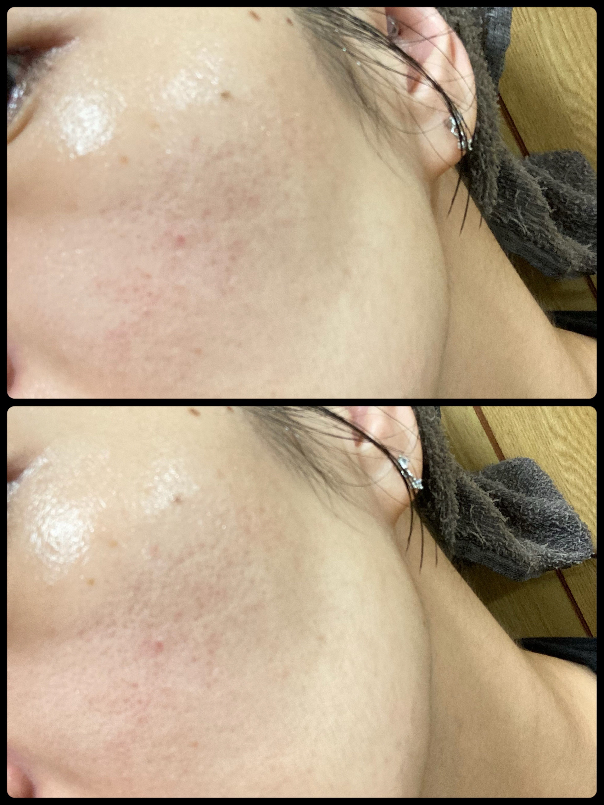 オングリディエンツ スキンバリアグローミスト/Ongredients/ミスト状化粧水を使ったクチコミ（3枚目）