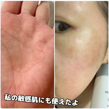 カラットCローション/Mon BAACE/化粧水を使ったクチコミ(3枚目)