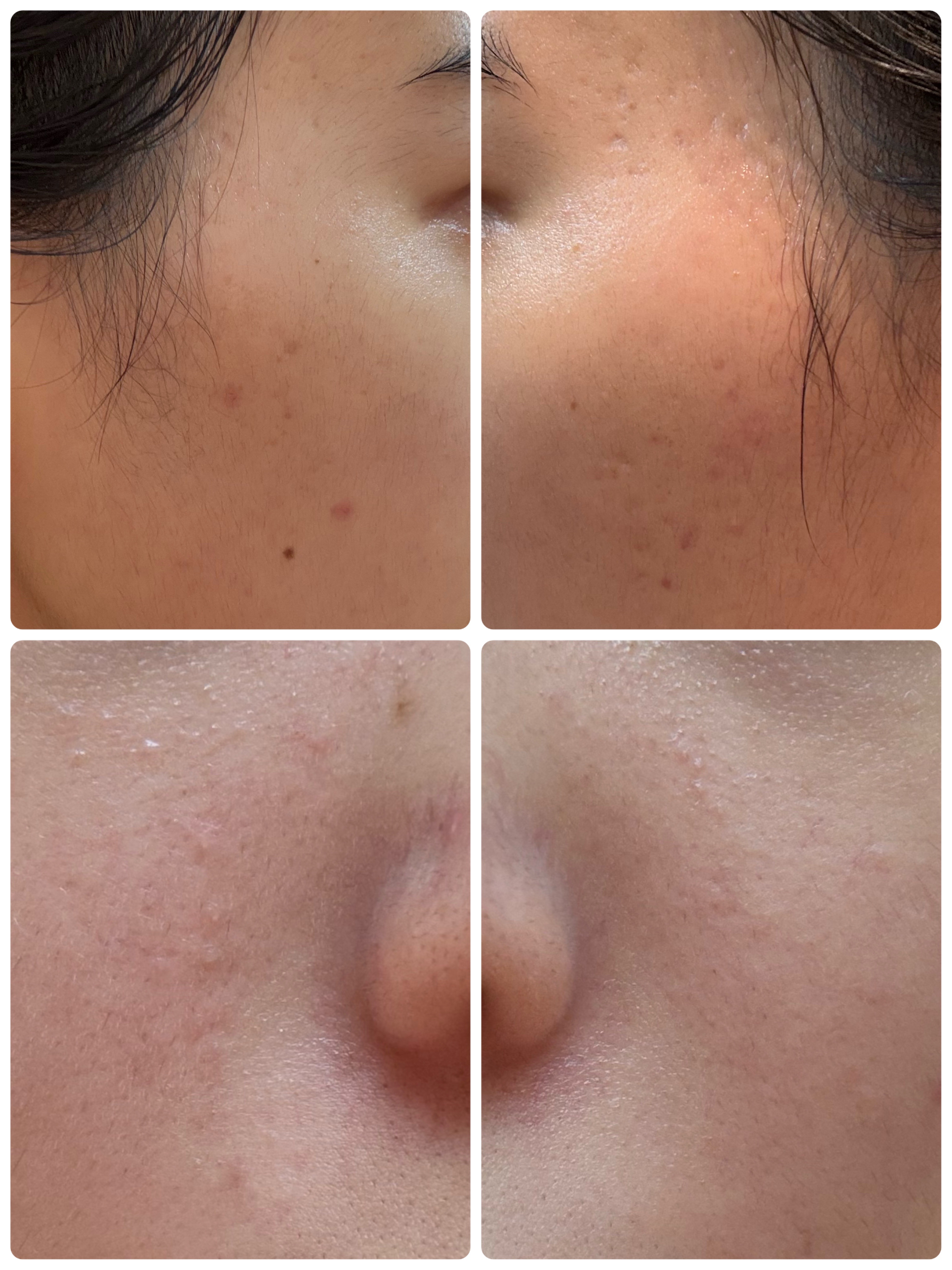 AGE-R ブースタープロ/MEDICUBE/美顔器・マッサージを使ったクチコミ（2枚目）