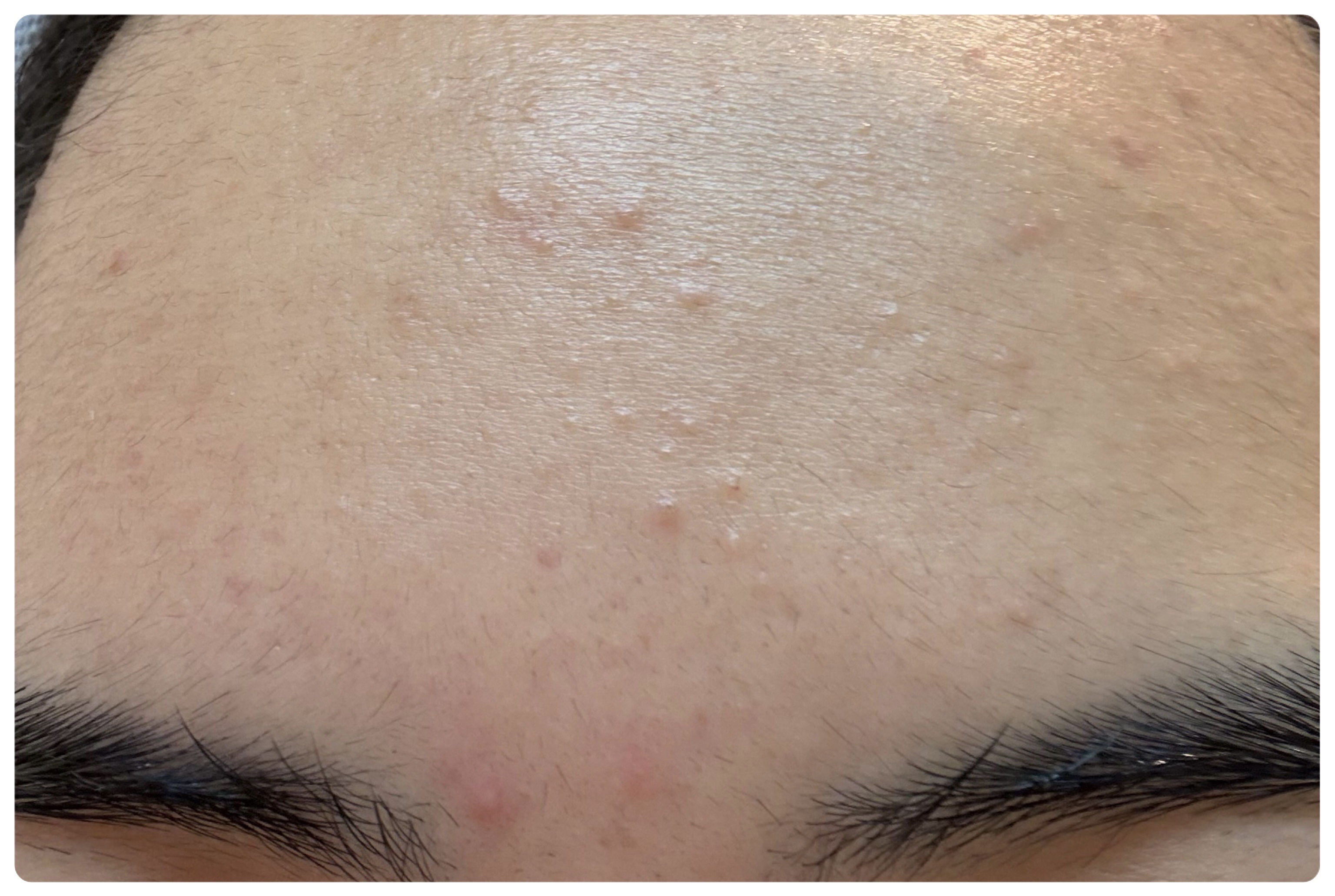 AGE-R ブースタープロ/MEDICUBE/美顔器・マッサージを使ったクチコミ（3枚目）