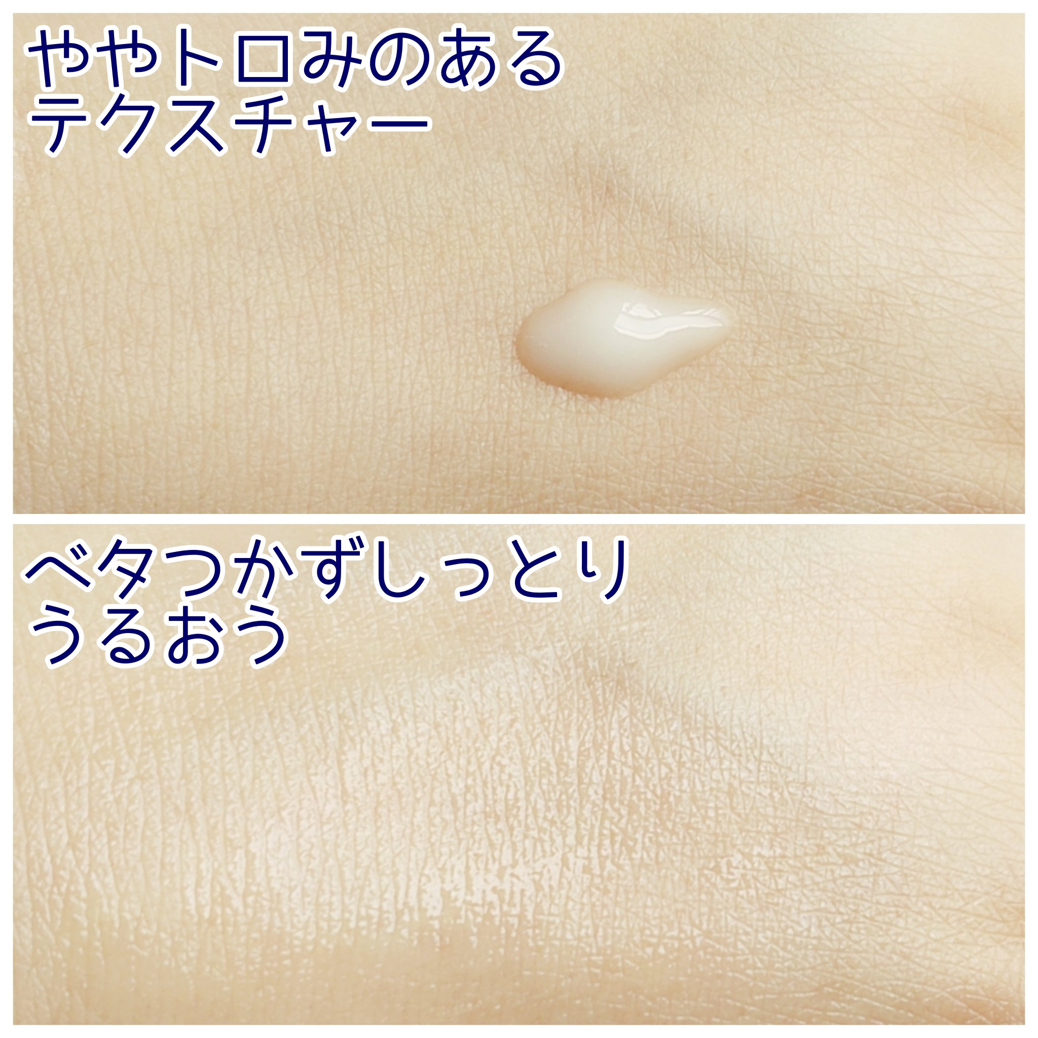 アットクリニックリンクルショットアンプル/DOMINAS/美容液を使ったクチコミ（3枚目）