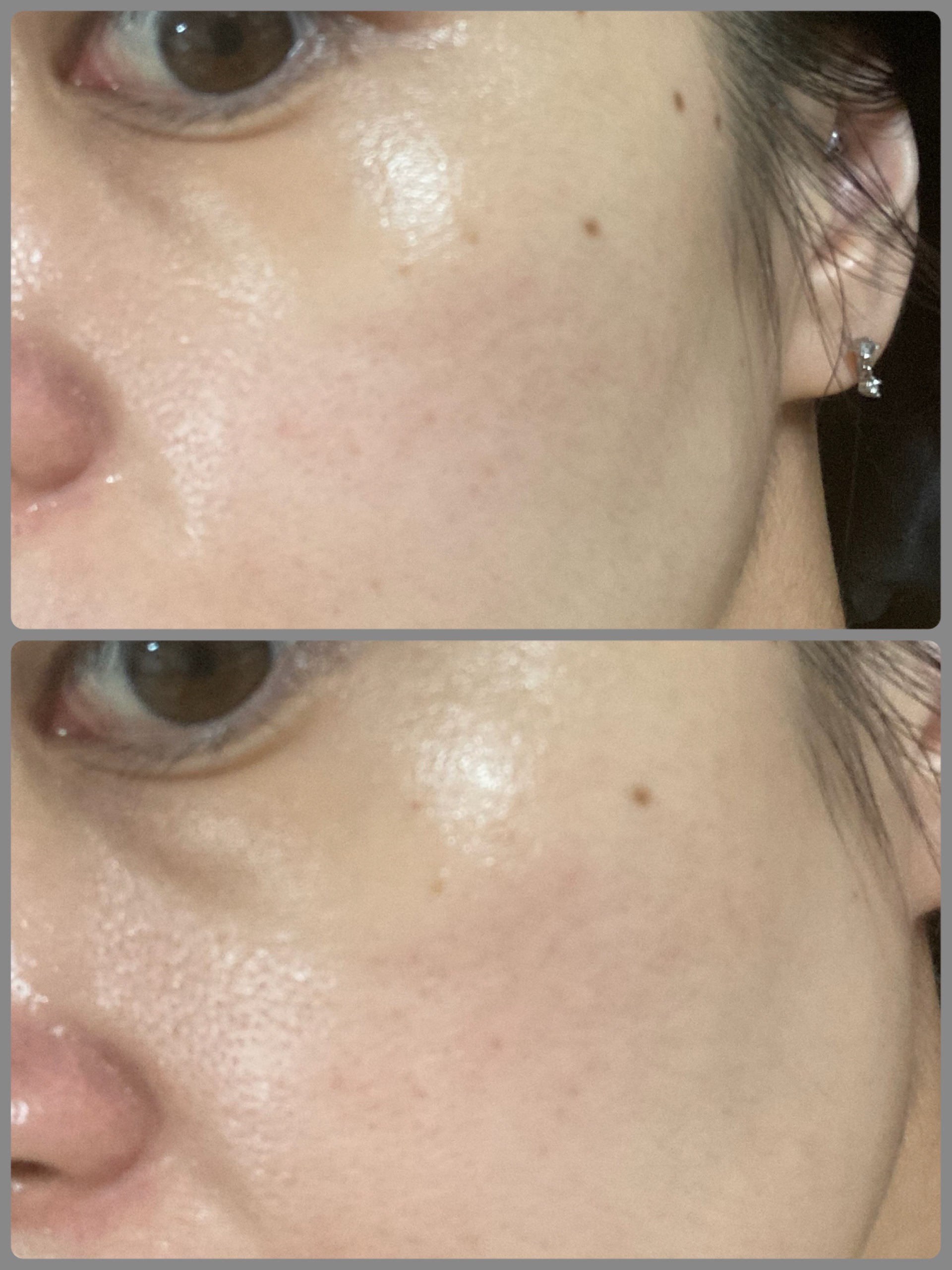 ユース ラディアンス ビタチノール セラム/primera/美容液を使ったクチコミ（3枚目）