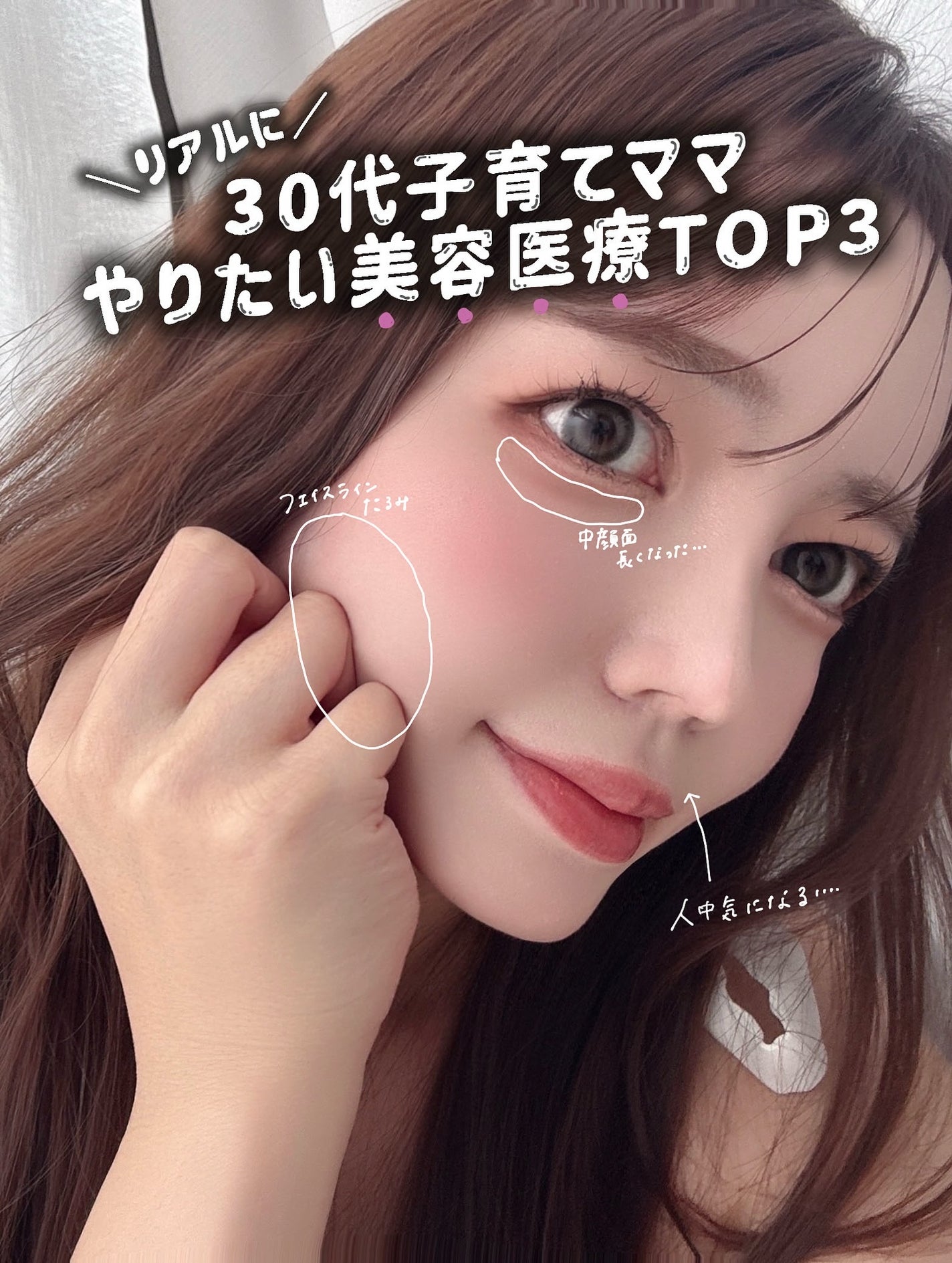ハルちゃん|ママでも美容頑張りたい🤍フォロバ💬保存お返し on LIPS 「\韓国🇰🇷で脂肪溶解注射をしたい子必見🤍/30代になってから色..」(1枚目)