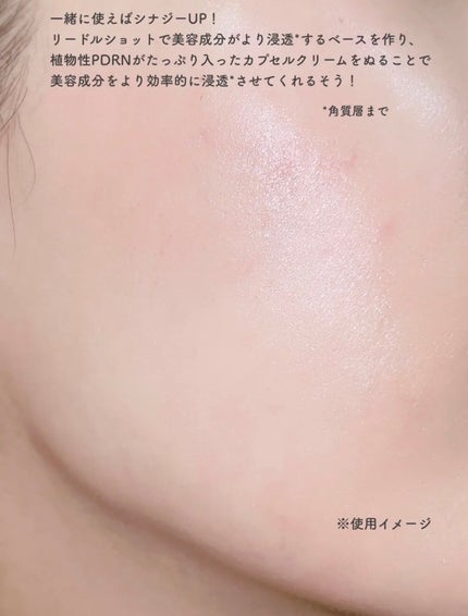 PDRN+リードルS 100/VT/美容液を使ったクチコミ(4枚目)