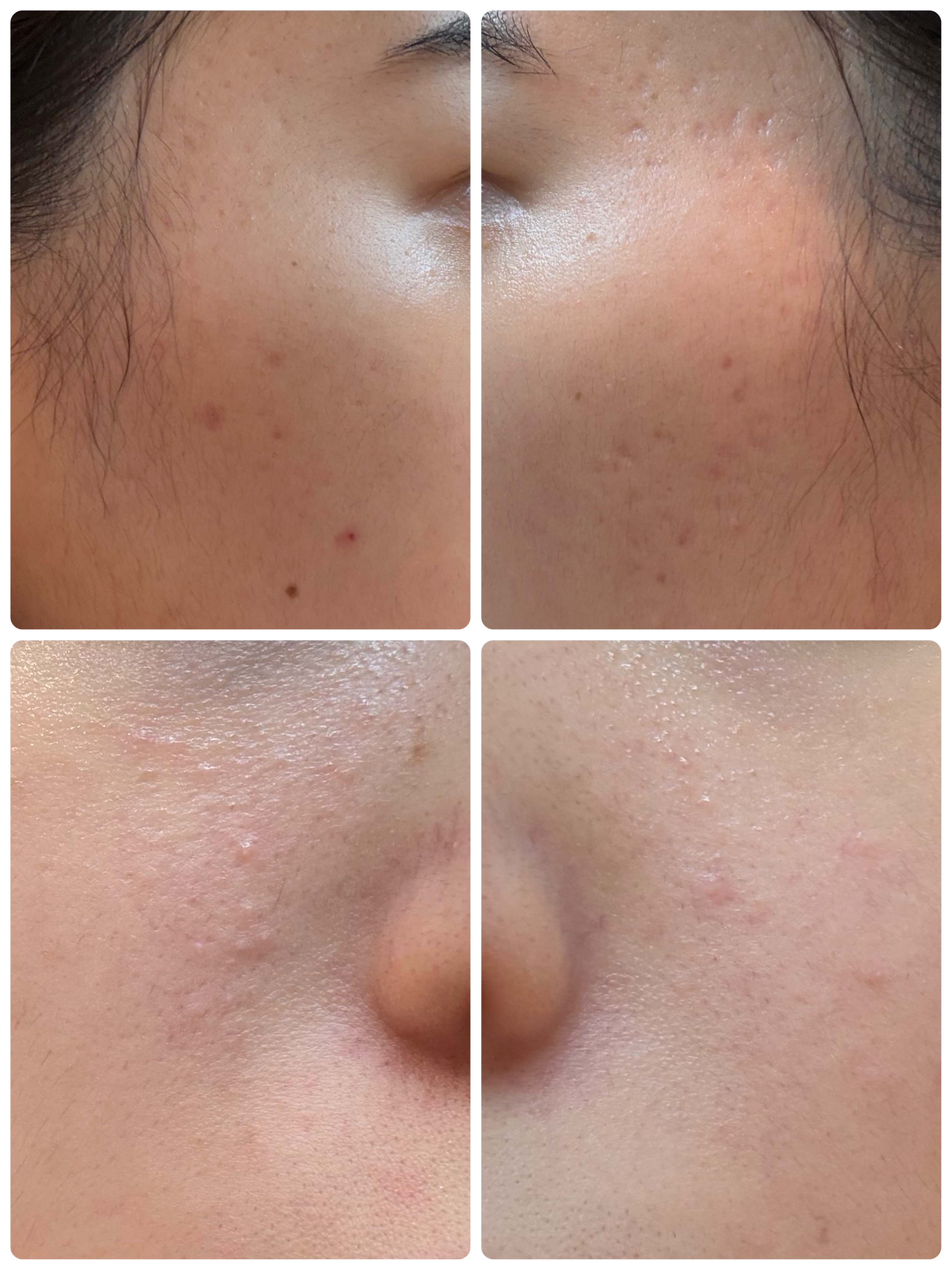 薬用雪肌精 ブライトニング クレンジング オイル[医薬部外品]/雪肌精/オイルクレンジングを使ったクチコミ（2枚目）