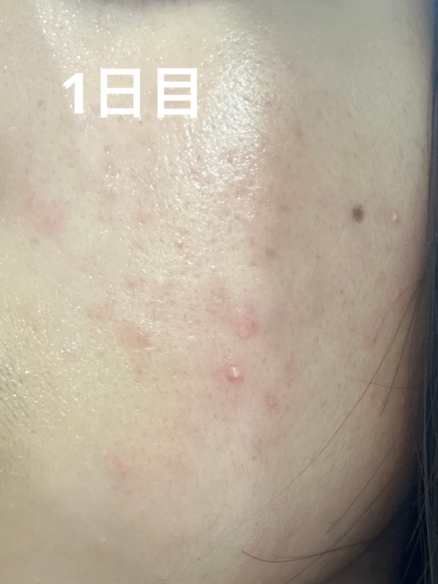 S100 リードル/VT/美容液を使ったクチコミ(5枚目)