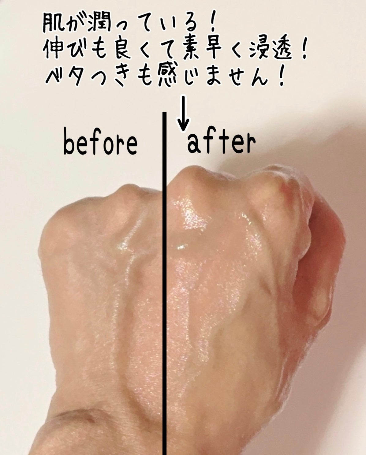 ケアセラAP 高保湿先行バリア乳液/ケアセラ/乳液を使ったクチコミ(5枚目)