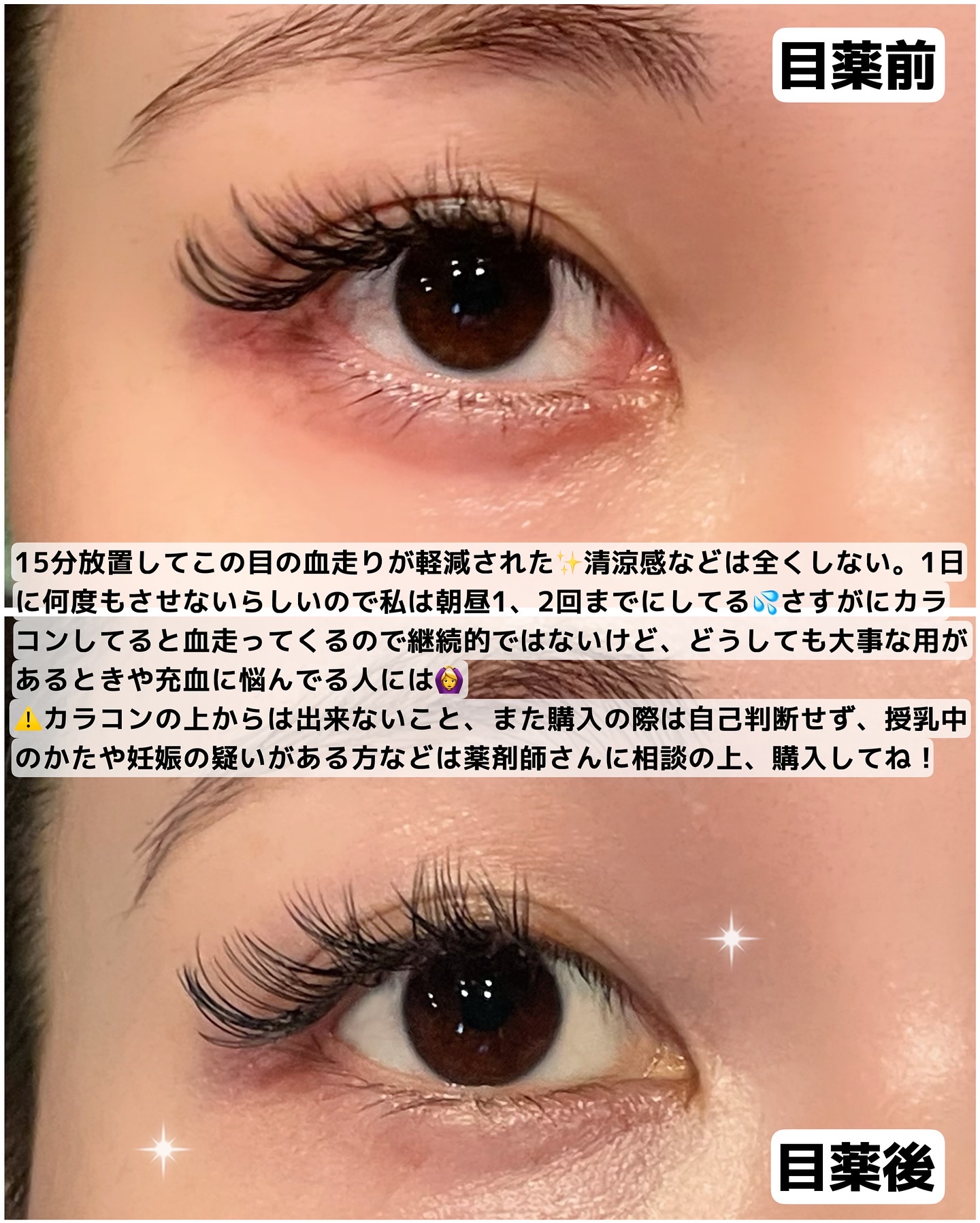 マイティアルミファイ（医薬品）/第一三共ヘルスケア/その他を使ったクチコミ（2枚目）