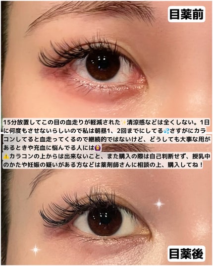 マイティアルミファイ(医薬品)/第一三共ヘルスケア/その他を使ったクチコミ(2枚目)