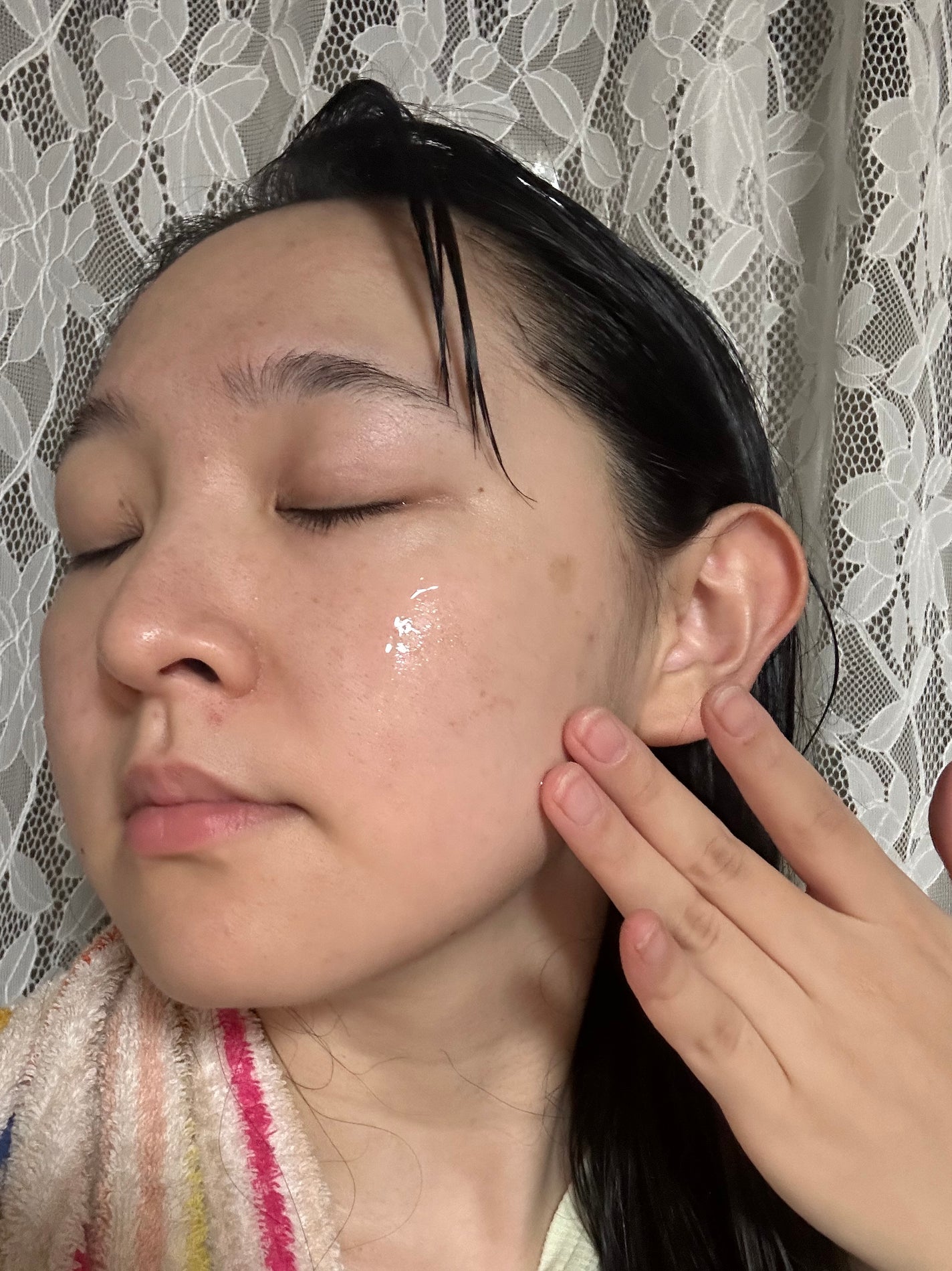 AZUSERA美容液/AZUSERA/美容液を使ったクチコミ(2枚目)