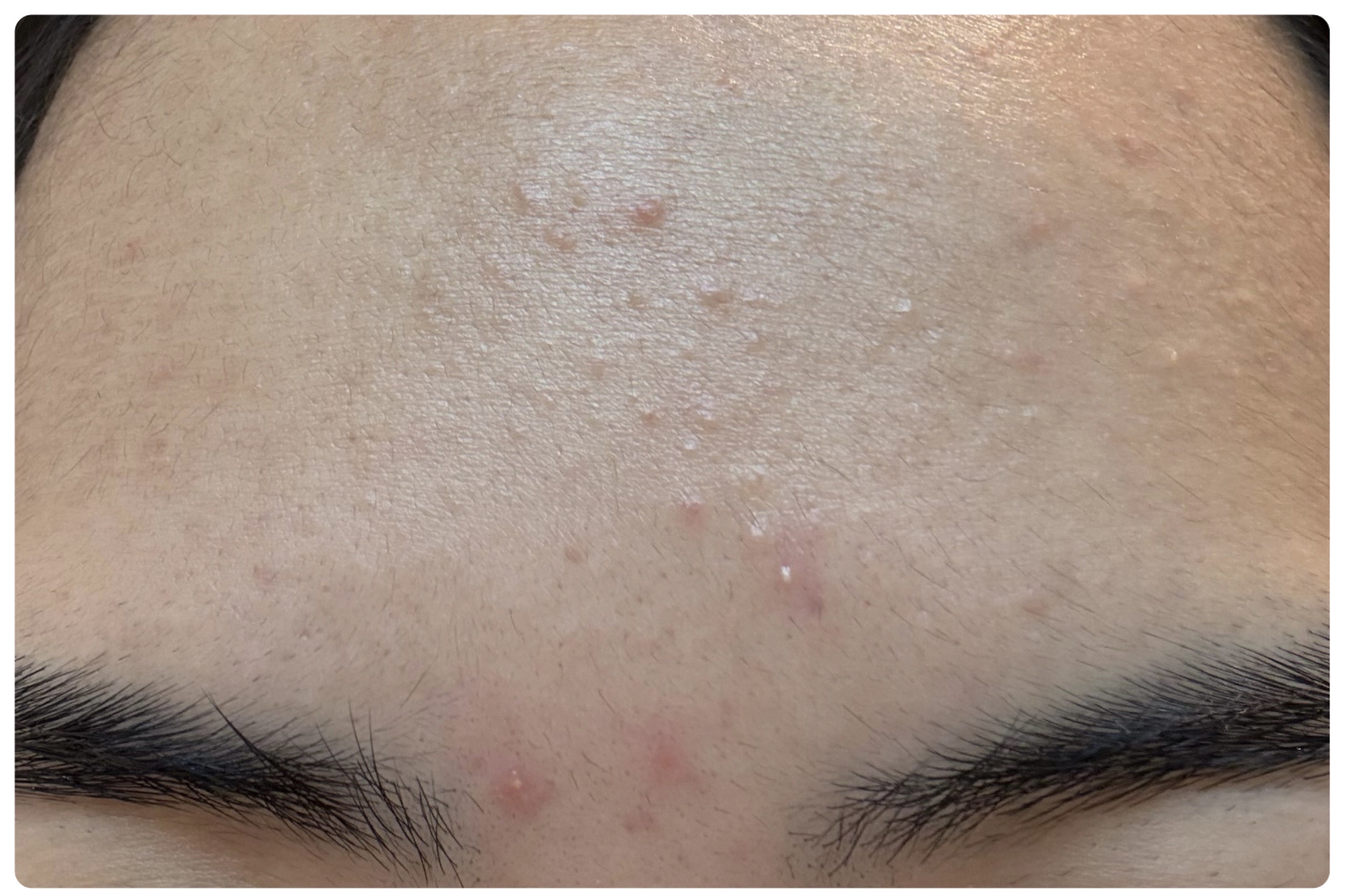 薬用雪肌精 ブライトニング クレンジング オイル[医薬部外品]/雪肌精/オイルクレンジングを使ったクチコミ（3枚目）