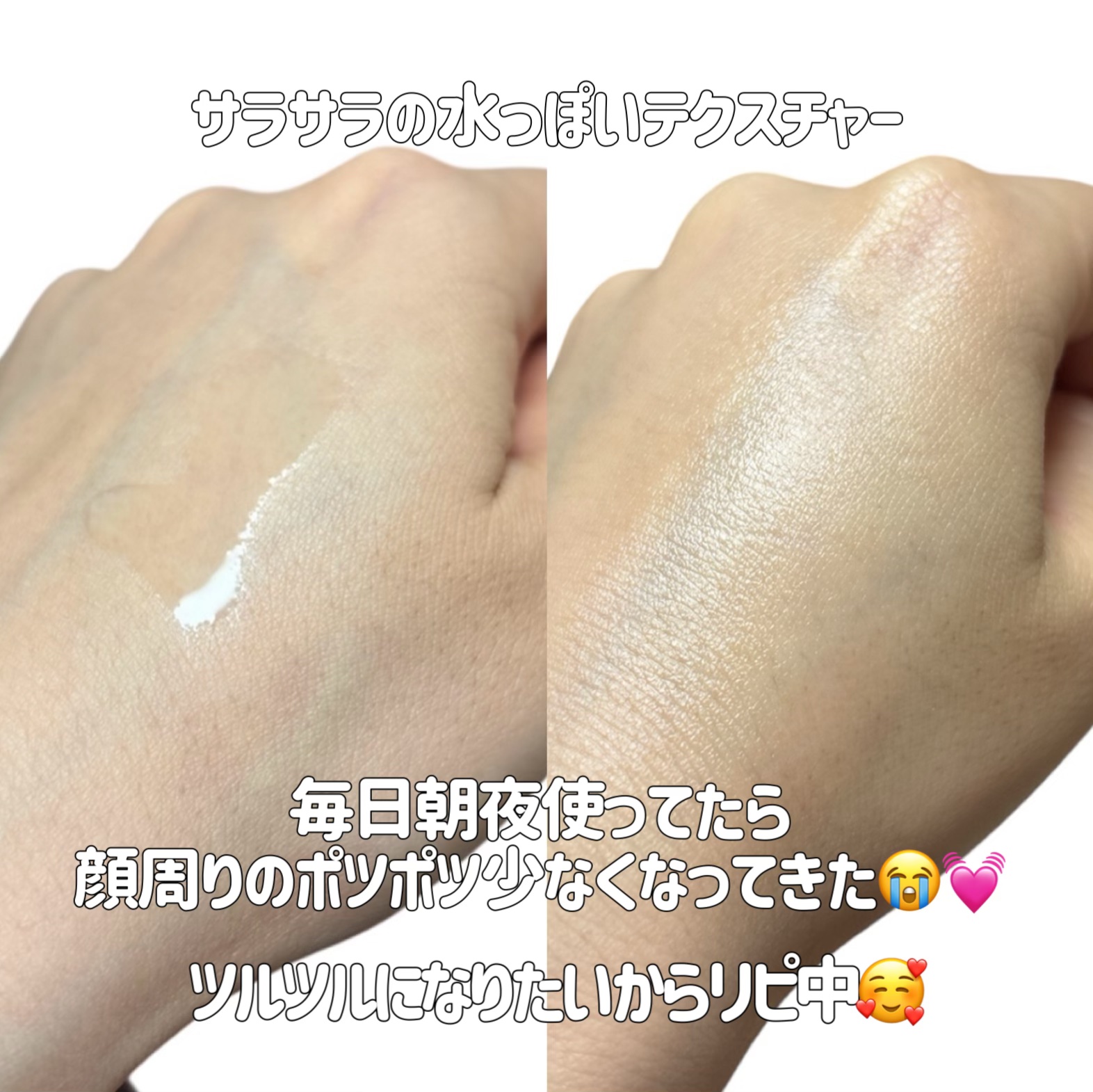 オーガニック ハトムギエキス (ヨクイニン)/KISO/その他を使ったクチコミ（3枚目）