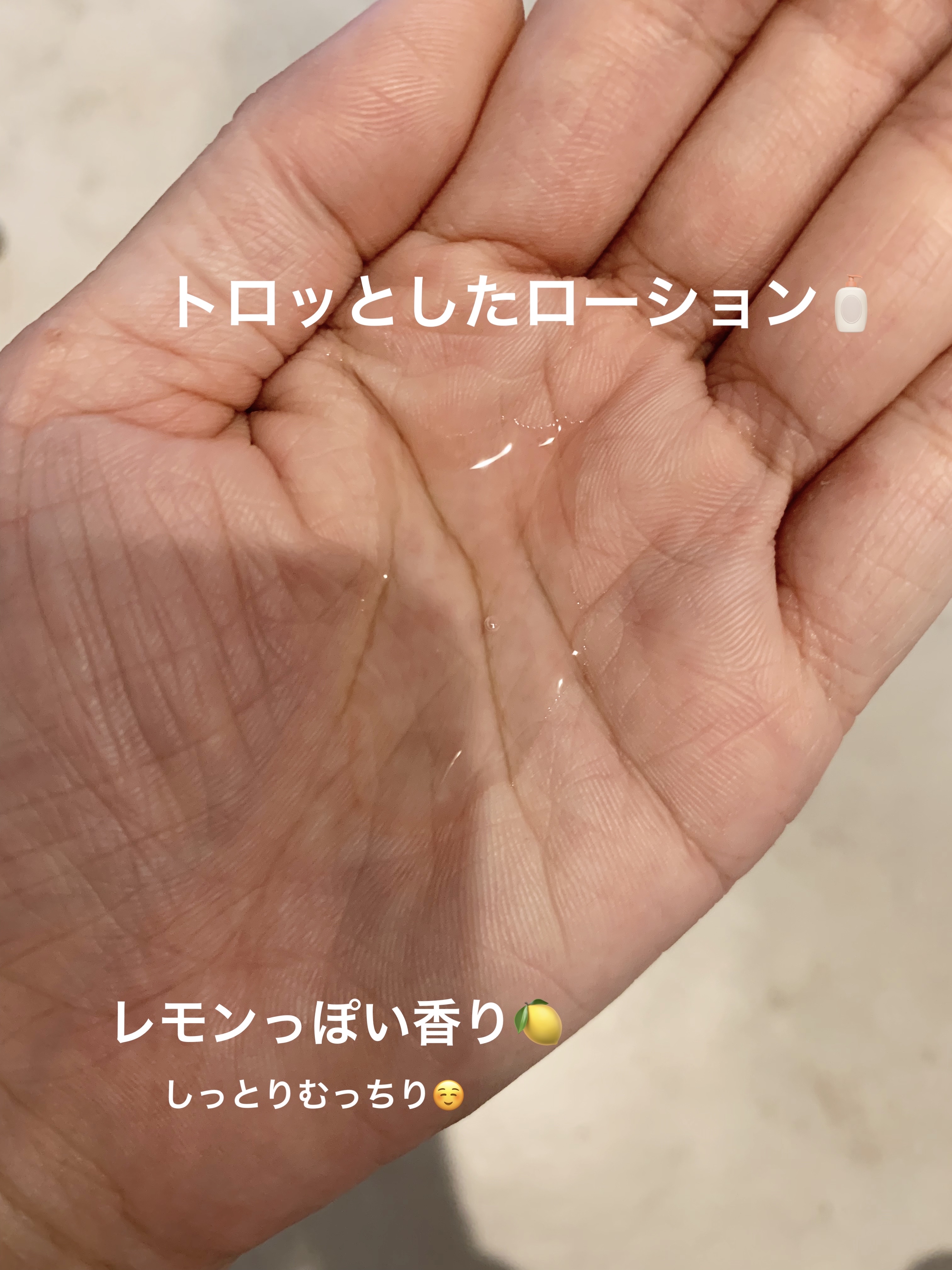 ダーマレーザー スーパーVC100ローション（しっとり）/クオリティファースト/化粧水を使ったクチコミ（2枚目）