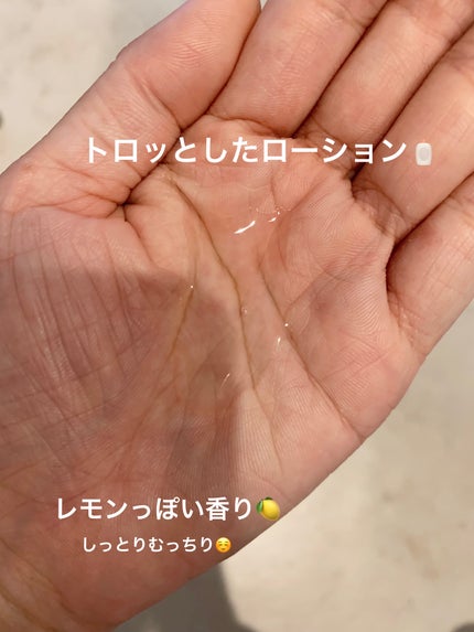 ダーマレーザー スーパーVC100ジェルクリーム/クオリティファースト/フェイスクリームを使ったクチコミ(2枚目)