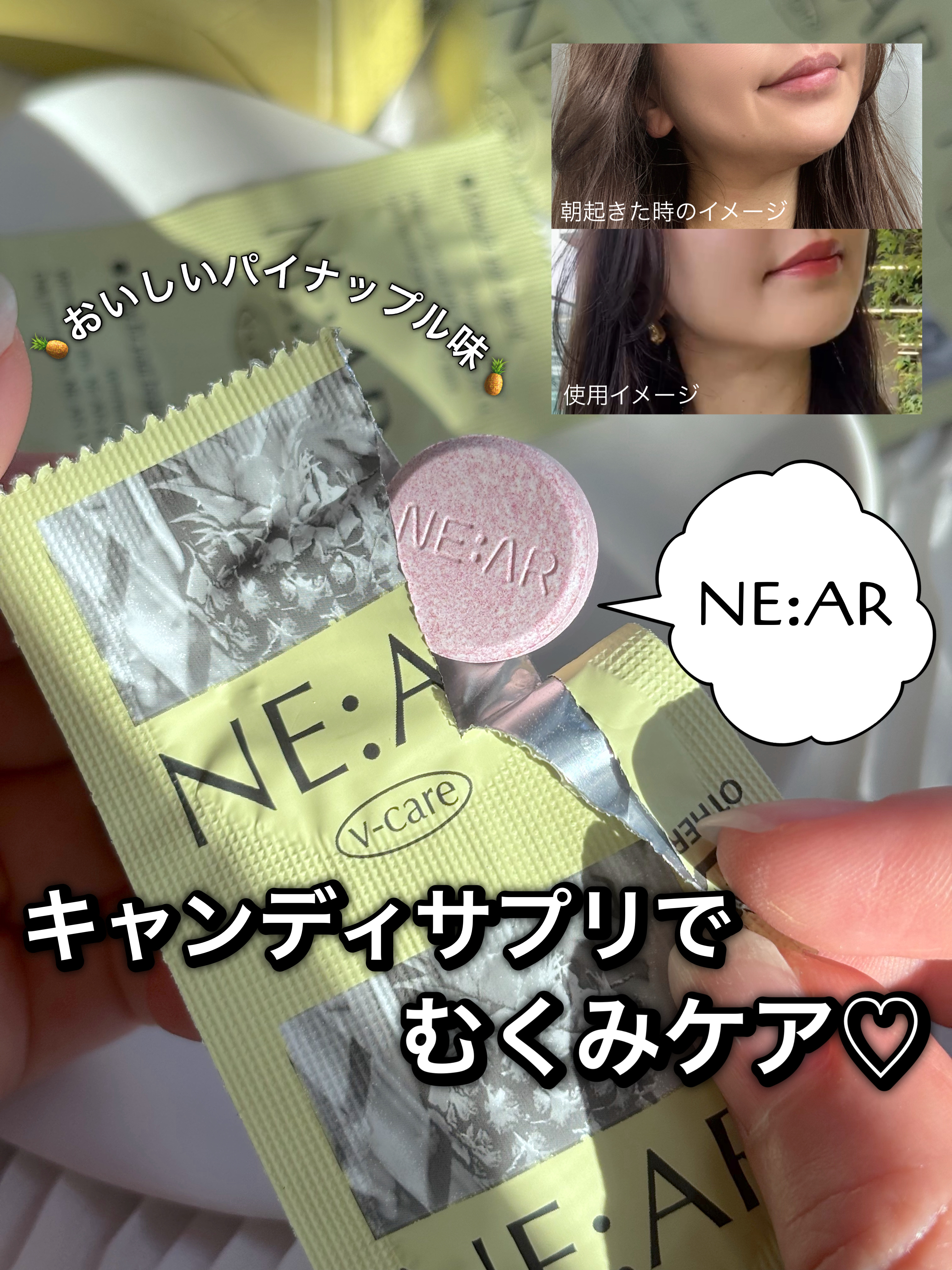 ニアル　Vケア/NE:AR/美容サプリメントを使ったクチコミ（1枚目）