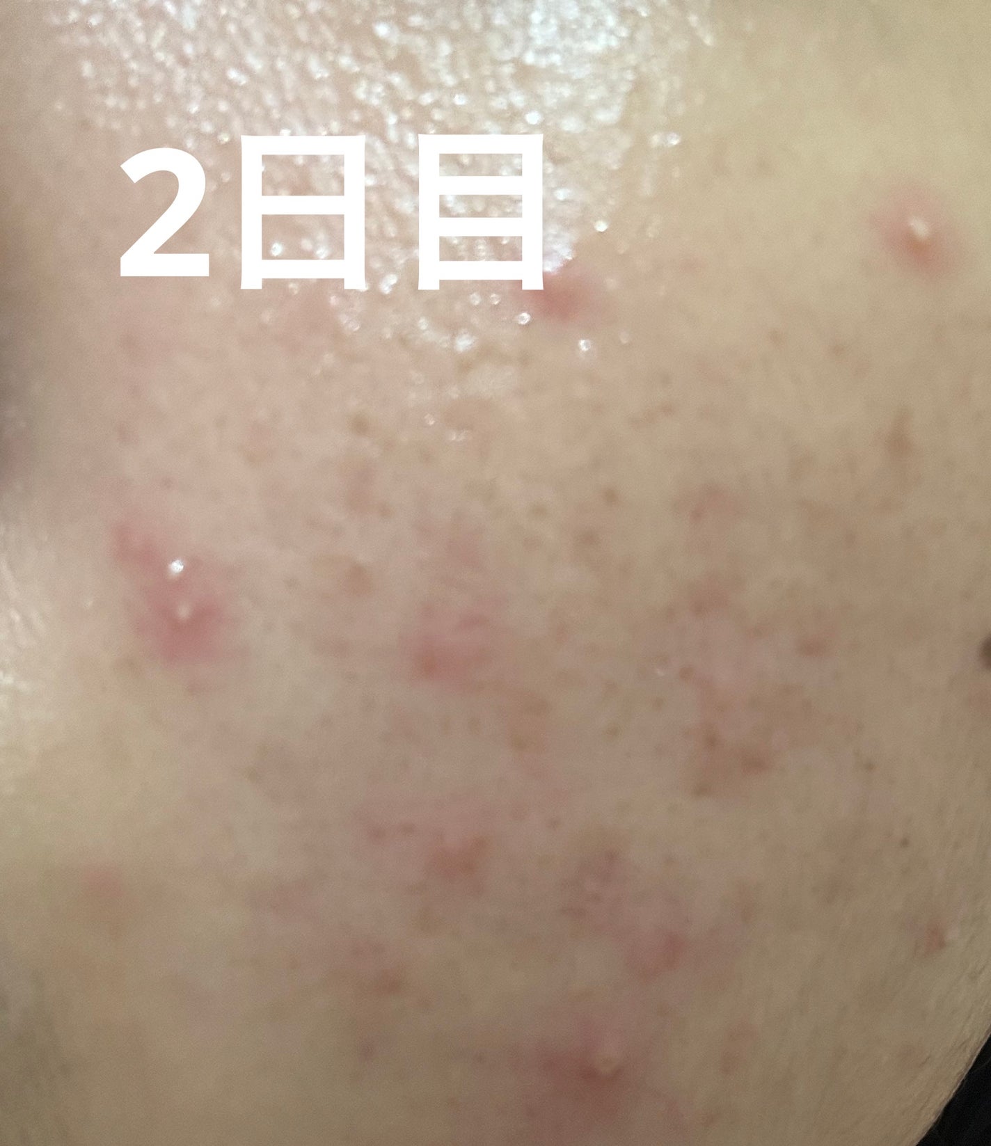 S100 リードル/VT/美容液を使ったクチコミ(4枚目)