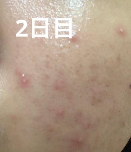 S100 リードル/VT/美容液を使ったクチコミ(4枚目)