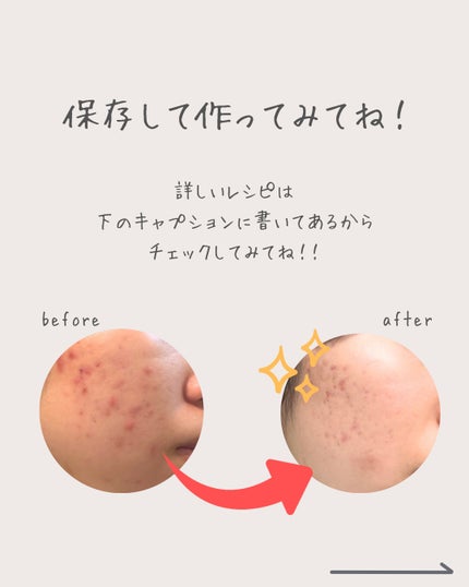 ãŸããð±èèãæ¹åã€ã³ããŒã±ã¢ on LIPS ããããªæ©ã¿ãããŸãããïŒâ¬ïžâ©ã¹ãã³ã±ã¢ããŠãã®ã«ã»ã»ã»âšç®è..ãïŒ9æç®ïŒ