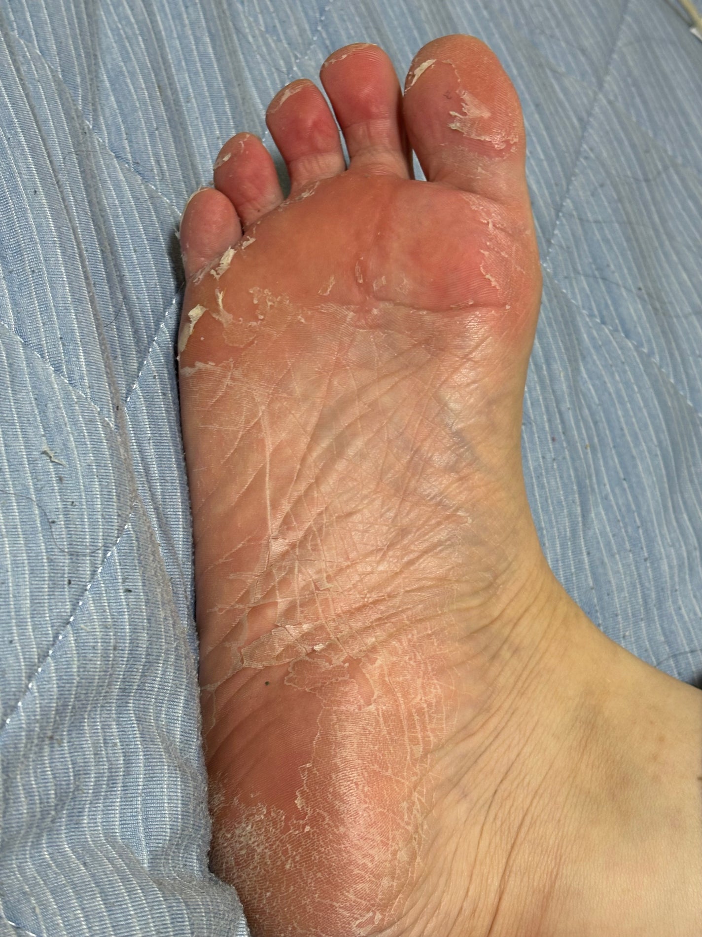 リードルショット リッチフットマスク/VT/レッグ・フットケアを使ったクチコミ(2枚目)