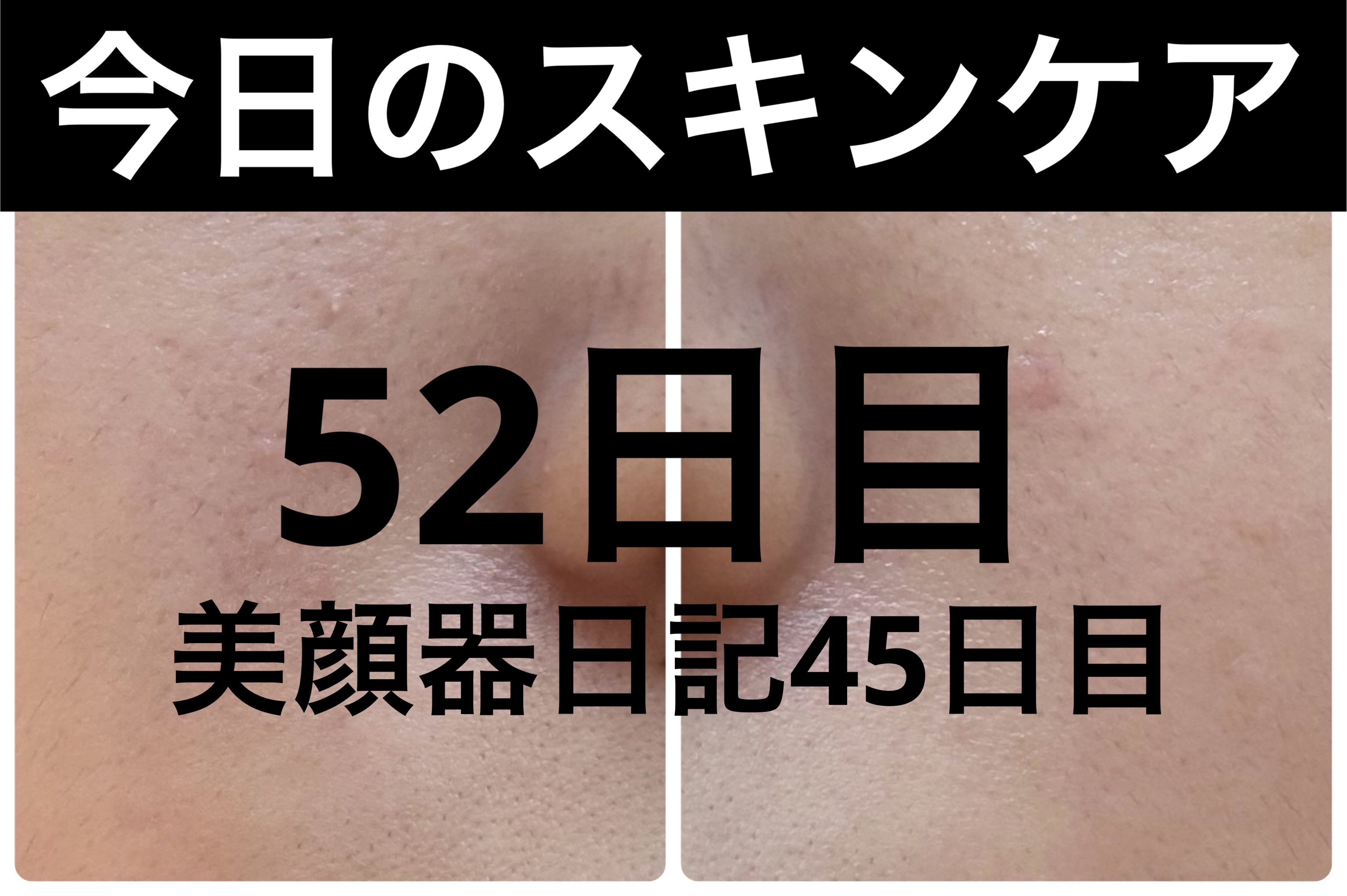 薬用雪肌精 ブライトニング クレンジング オイル[医薬部外品]/雪肌精/オイルクレンジングを使ったクチコミ（1枚目）