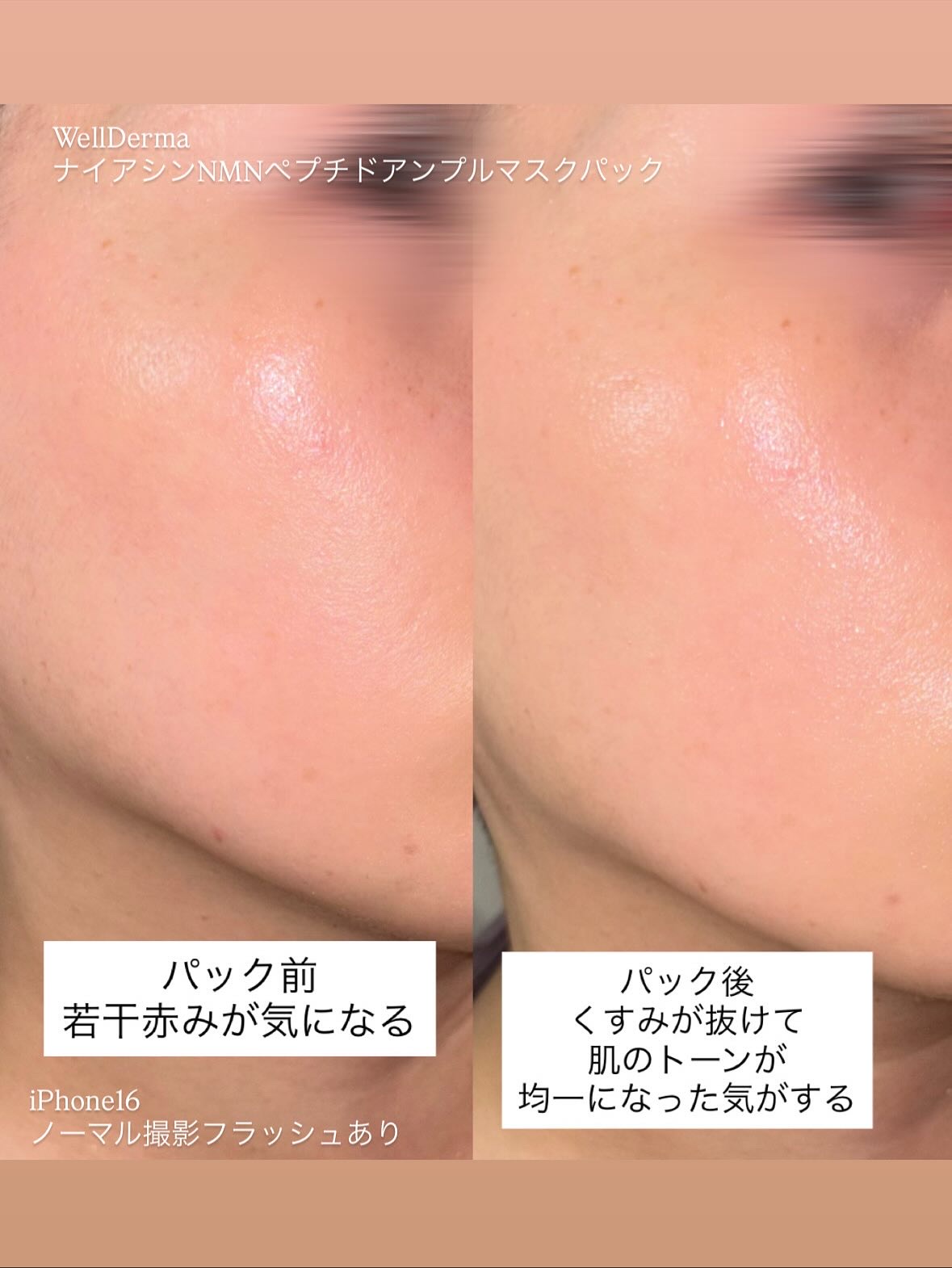 ナイアシンNMNペプチドアンプルマスクパック/WellDerma/シートマスク・パックを使ったクチコミ（3枚目）