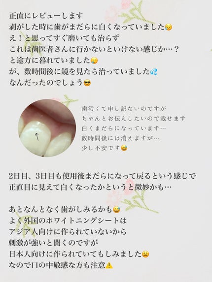 comecamu/カムカム はみがきシート(1箱/7枚入)/SHOBIDO/その他オーラルケアを使ったクチコミ(5枚目)