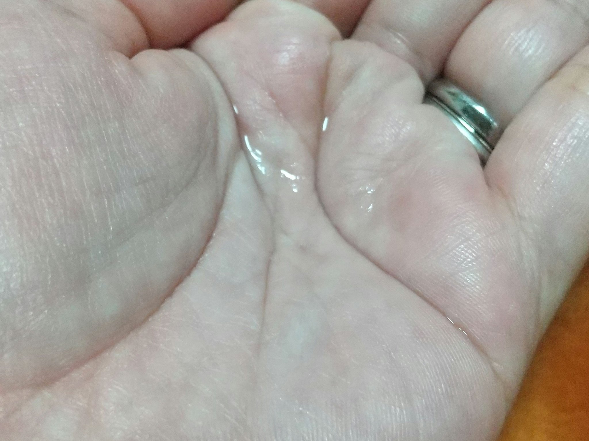 フラルネ ハイドロボム プラス/ALBION/化粧水を使ったクチコミ（3枚目）