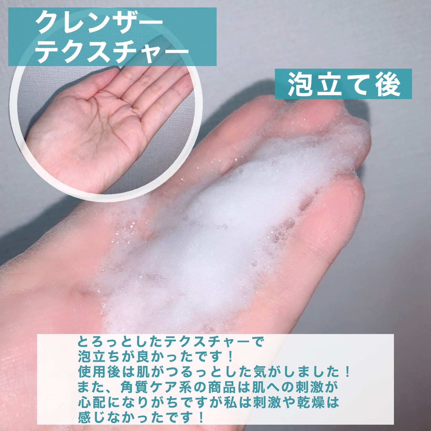 セタフィル ジェントルSAクレンザー/セタフィル/ピーリングを使ったクチコミ(4枚目)