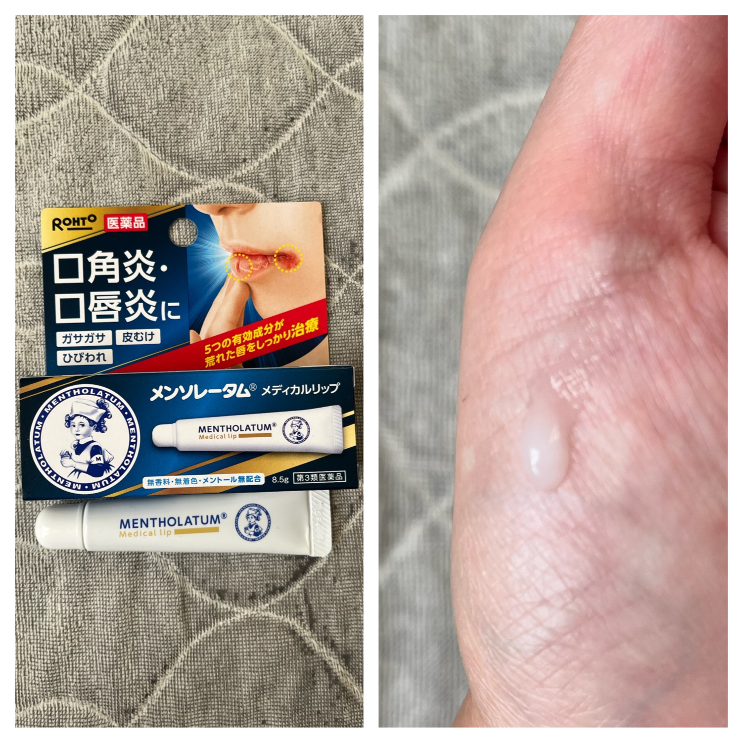 メディカルリップnc（医薬品）/メンソレータム/その他を使ったクチコミ（1枚目）