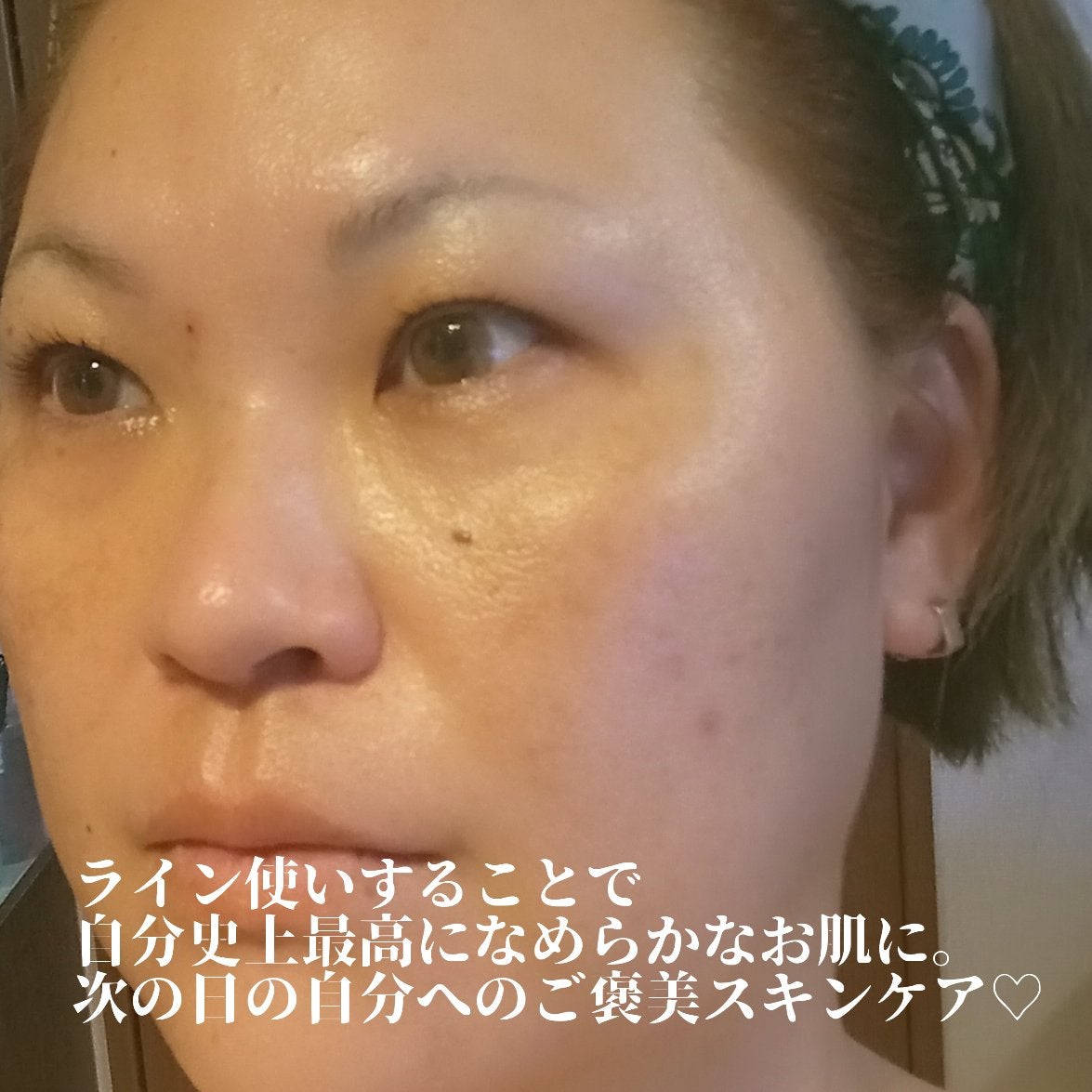 リペアジェル/リソウコーポレーション/美容液を使ったクチコミ(8枚目)