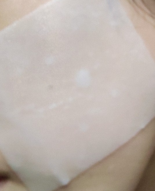 リズム ピコレーザー ニードルスポットパック/RISM/シートマスク・パックを使ったクチコミ(2枚目)