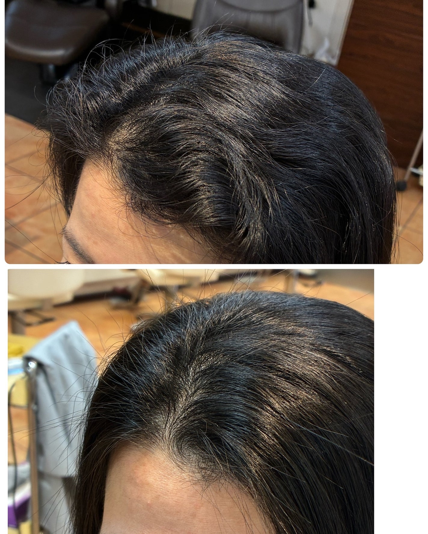 ð¥ð¢ð¬ð.ðððð çŸå®¹ã©ã€ã¿ãŒ on LIPS ãä¹
ãã¶ãã®çŸå®¹é¢ãã£ã±ãæŸçœ®ããŠããšé«ªã也ãã«ãããªã£ããæã..ãïŒ3æç®ïŒ