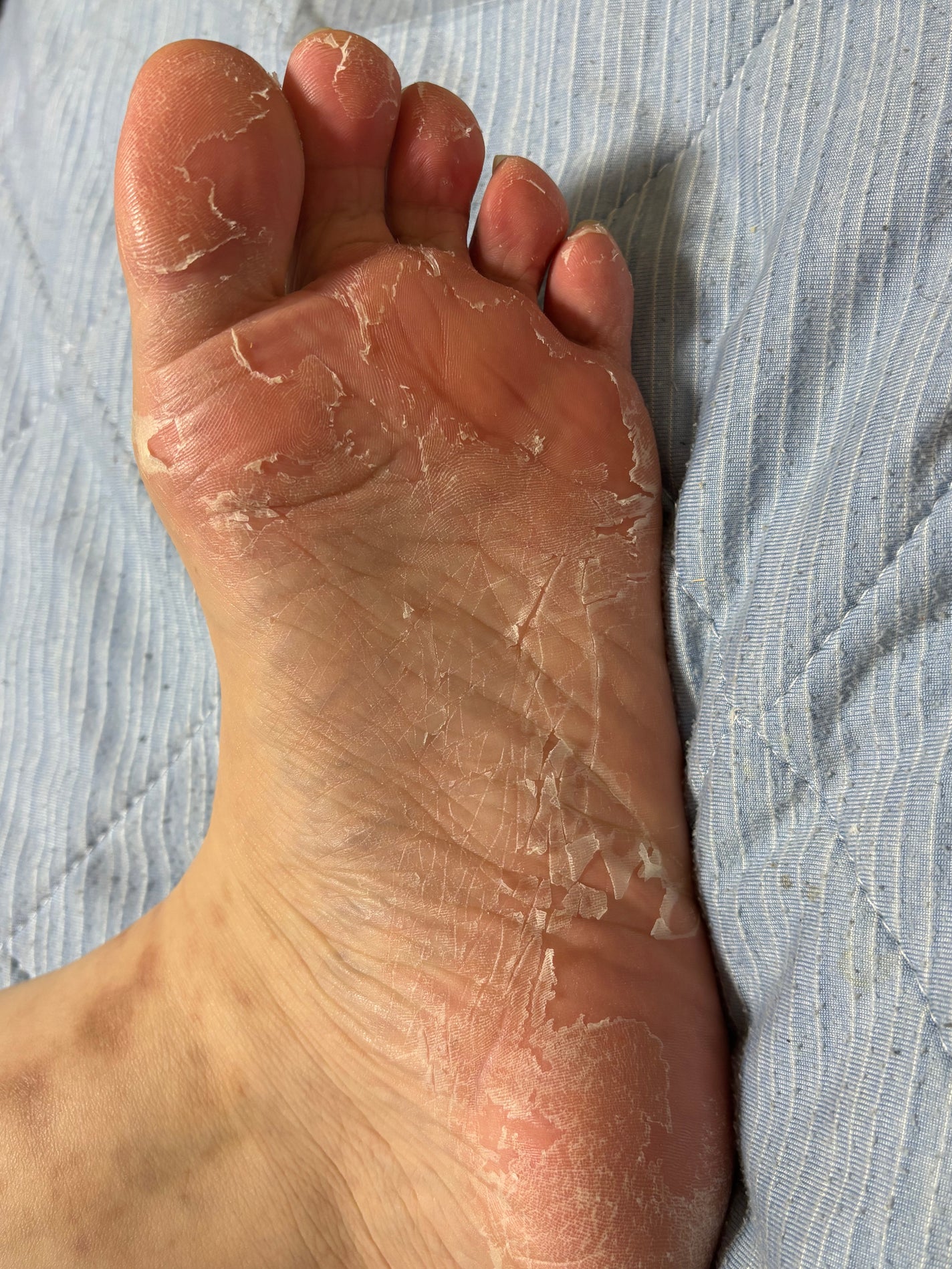 リードルショット リッチフットマスク/VT/レッグ・フットケアを使ったクチコミ(3枚目)