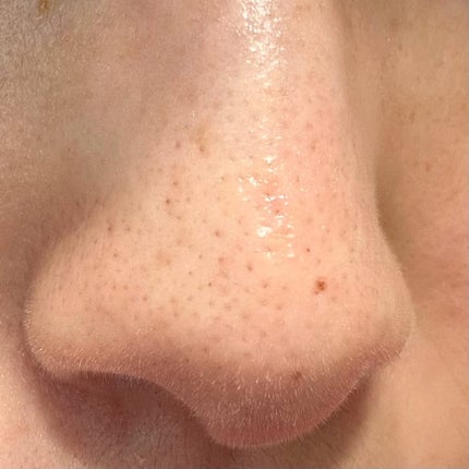 ブラックチェリー毛穴収縮クリーム ルフティグ/ODELOI/フェイスクリームを使ったクチコミ(7枚目)