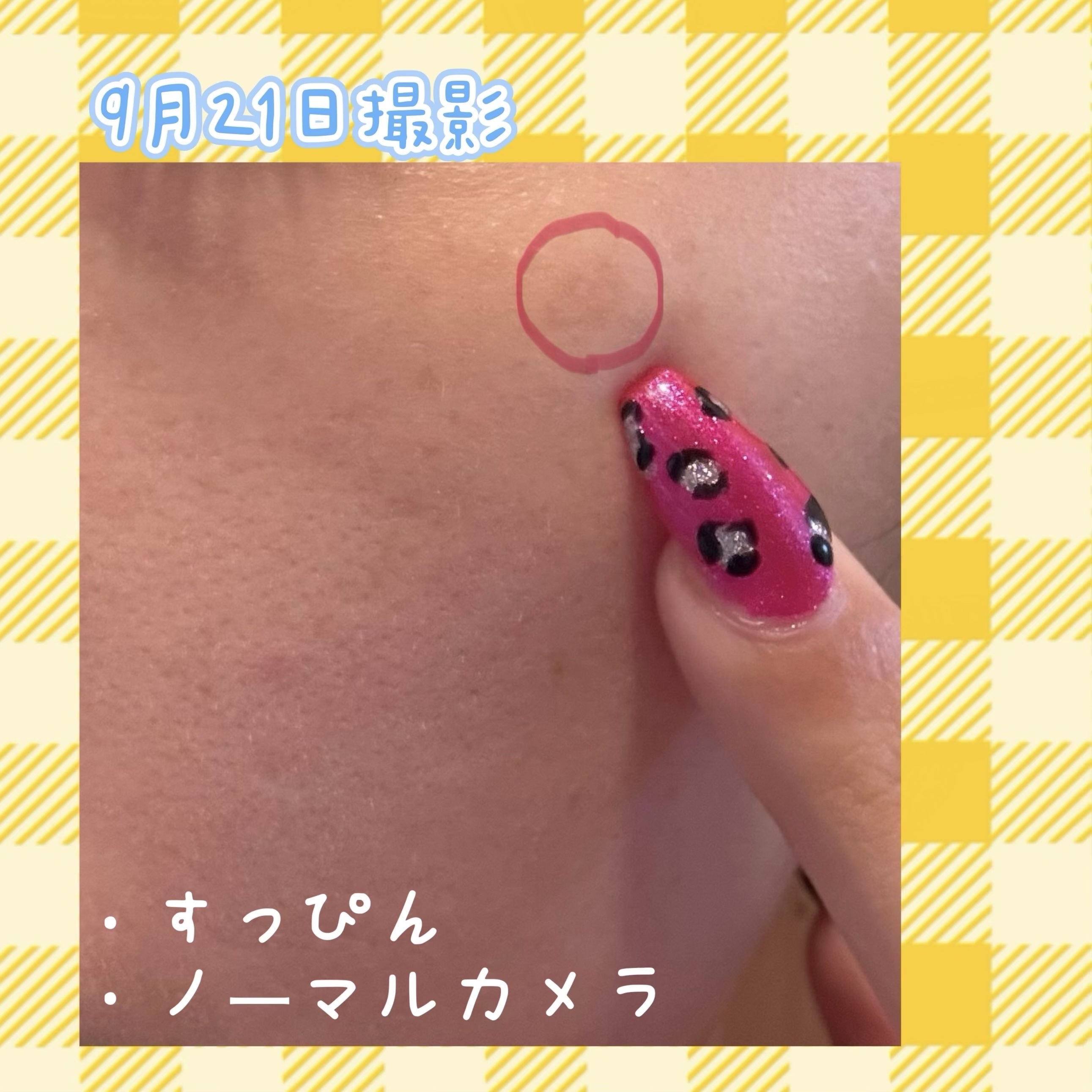 ポア ブライトニング シミケアセラム/celimax/美容液を使ったクチコミ（2枚目）