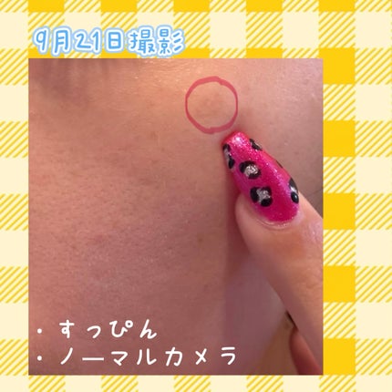 ポア ブライトニング シミケアセラム/celimax/美容液を使ったクチコミ(2枚目)