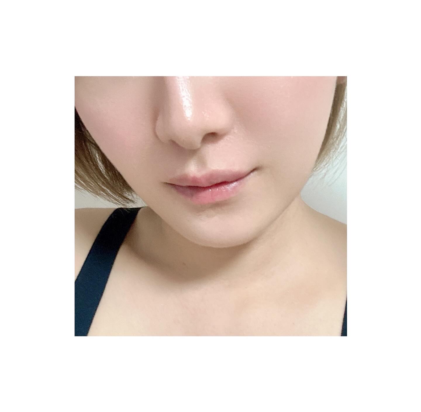 極薄透明パッチ nikipa!/金冠堂/にきびパッチを使ったクチコミ（2枚目）