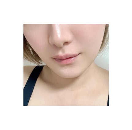 金冠堂 極薄透明パッチ nikipa!のクチコミ「.
周りに見せたくないニキビ跡を
自然にカバーしながらケア出来るスグレモノ 🤍
.
極薄0.0.....」(2枚目)