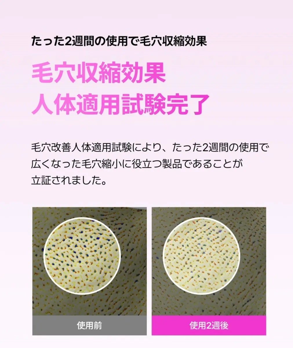 ブラックチェリー 毛穴引き締めクリーム ロフディ/ODELOI/フェイスクリームを使ったクチコミ(2枚目)