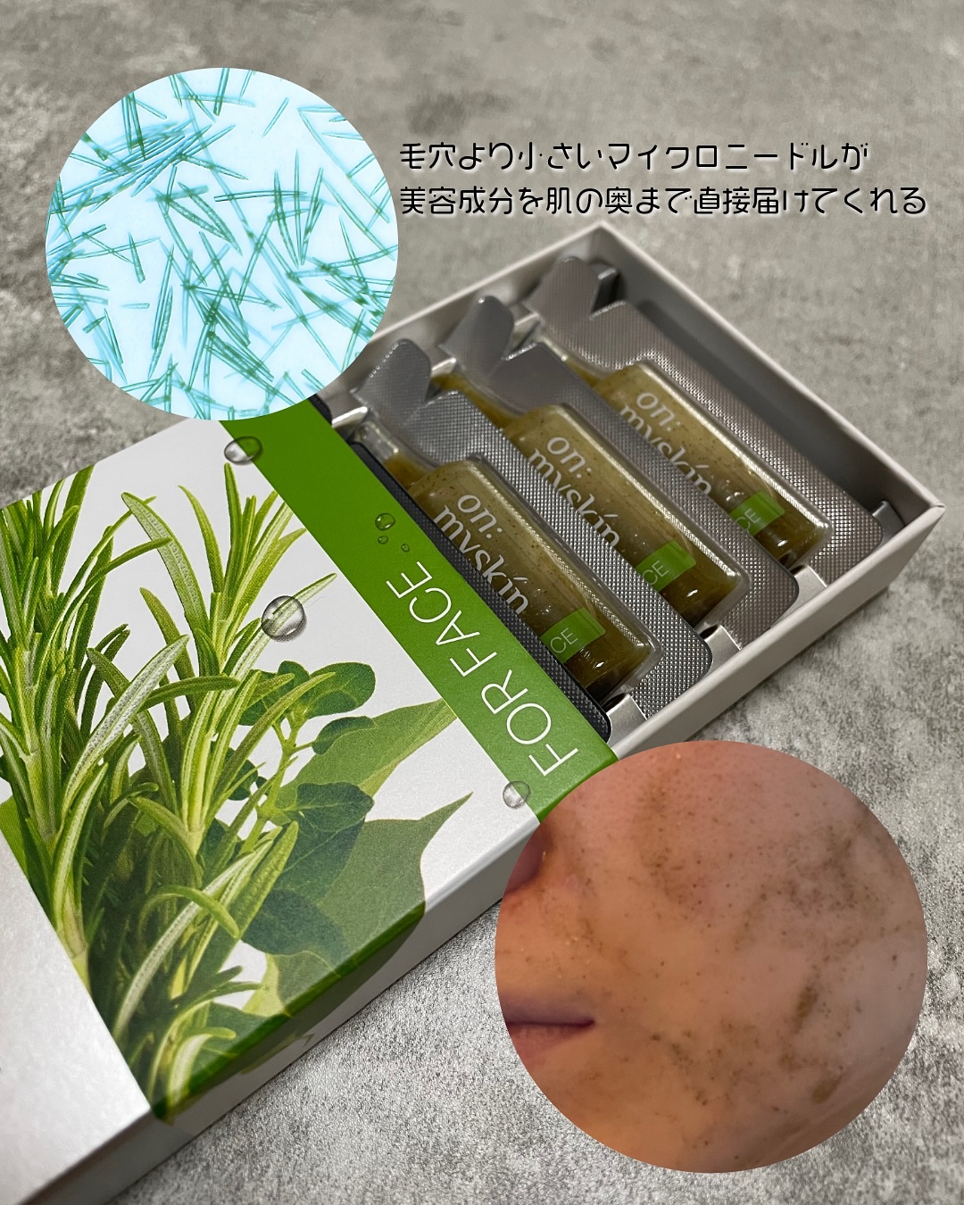 ハーブピーリング｜on:myskinの口コミ - ちょこ