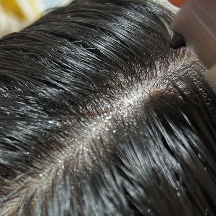 アデノバイタル スカルプ パワーショット/サブリミック/頭皮ローションを使ったクチコミ(4枚目)