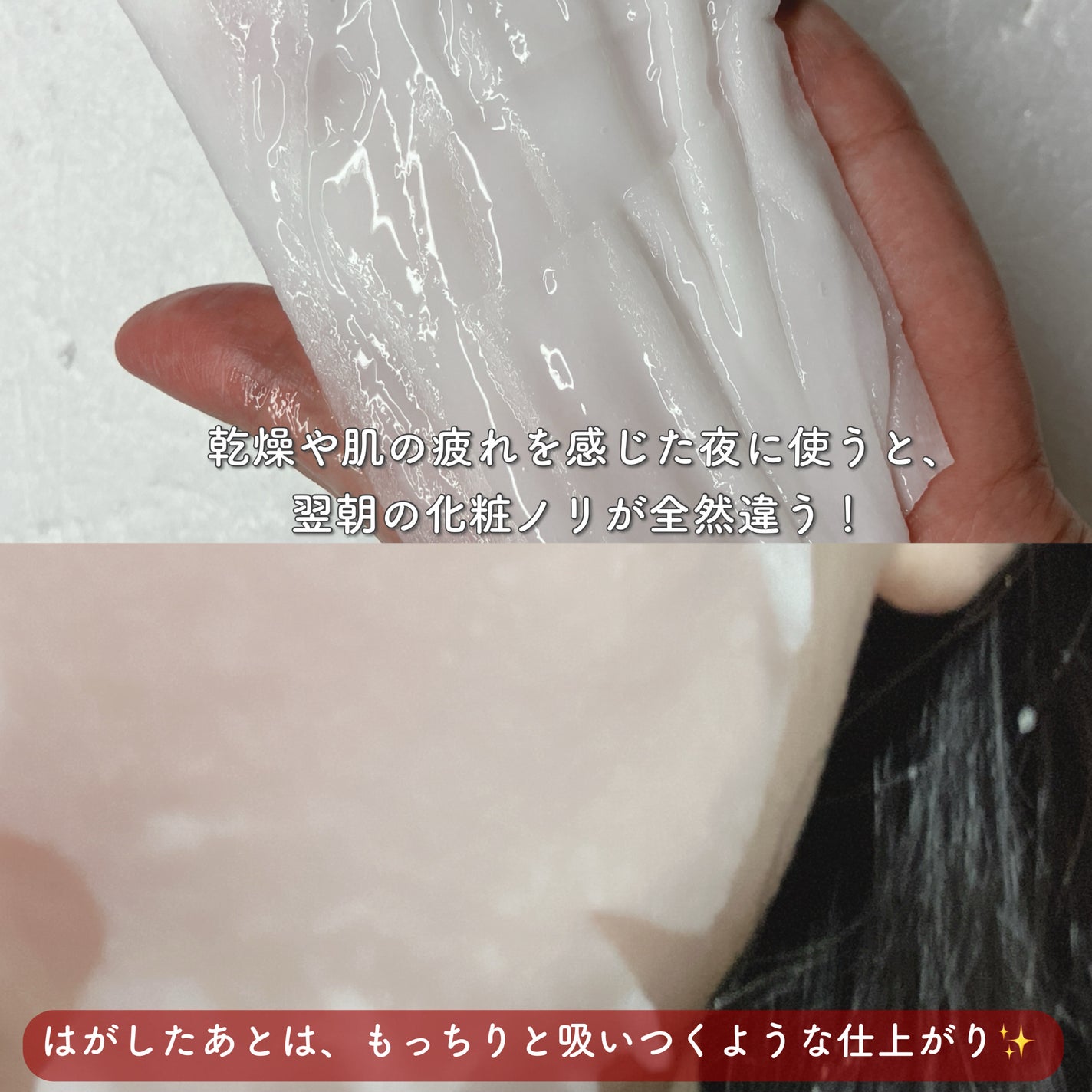 PDRN+リードルS 100/VT/美容液を使ったクチコミ(5枚目)