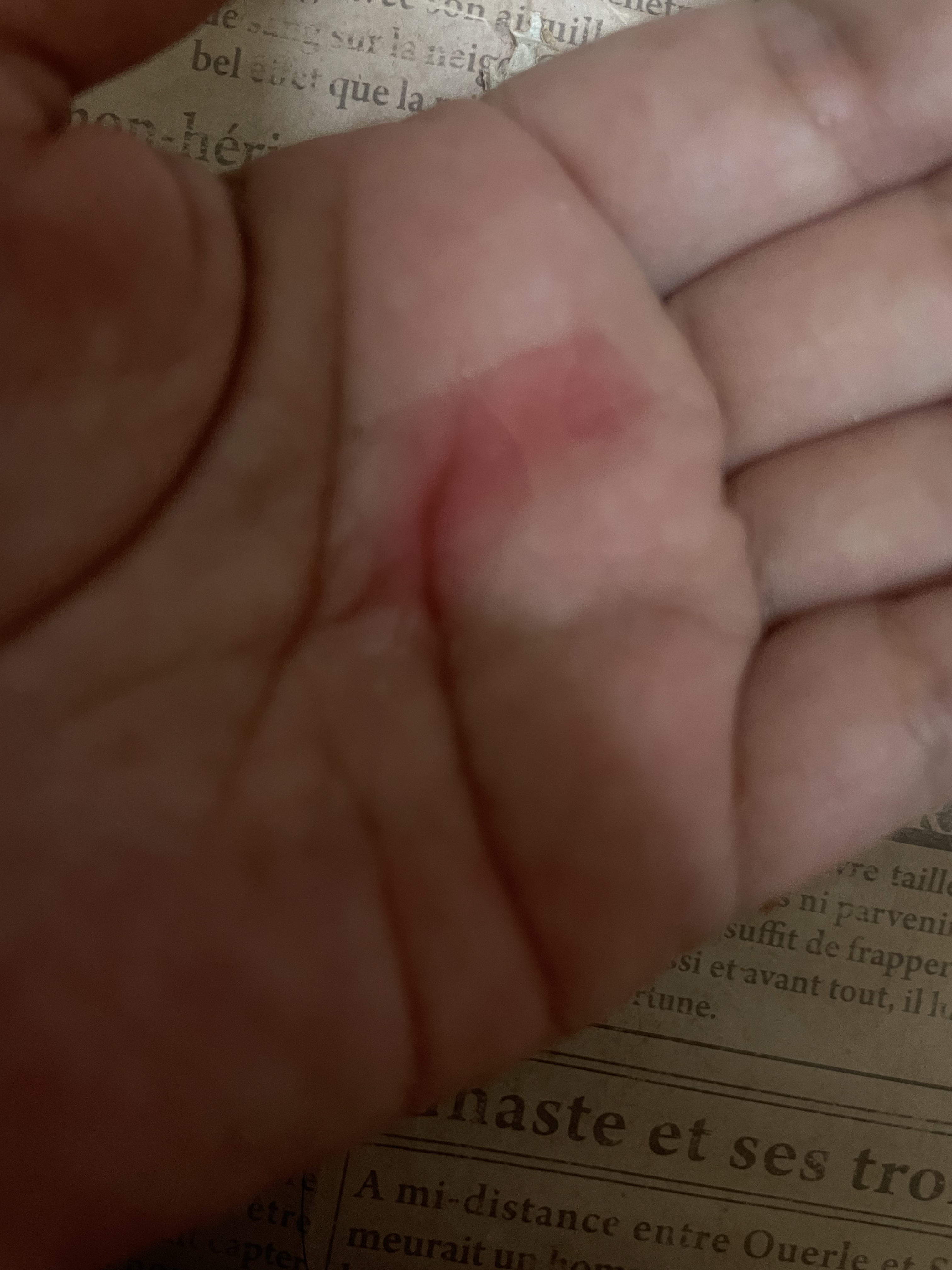 ダークスポットセラム/Anua/美容液を使ったクチコミ（3枚目）