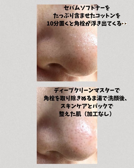 ディープクリーンマスター/ilso/その他スキンケアグッズを使ったクチコミ(6枚目)